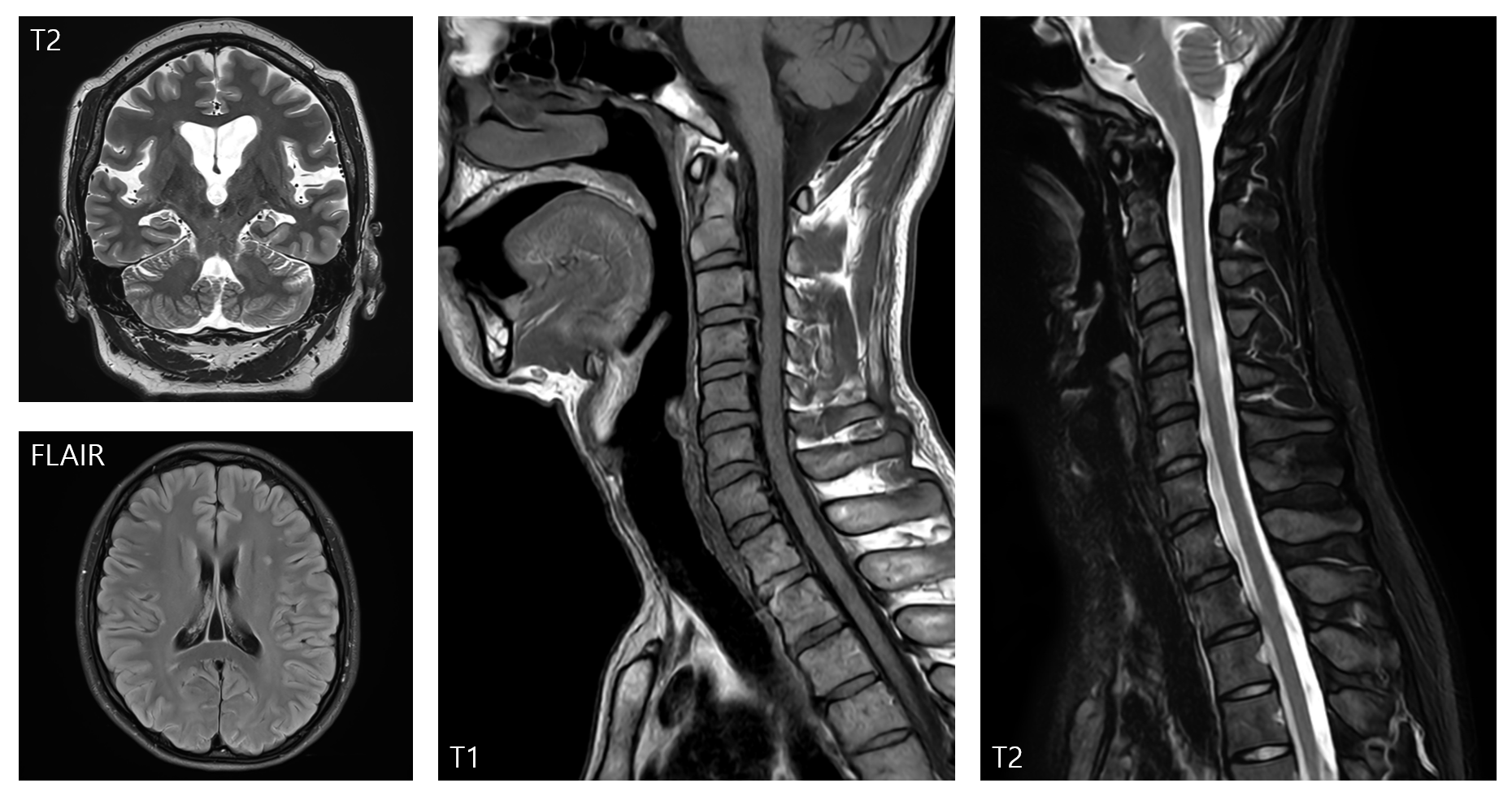 MRI Sample image by different sequences