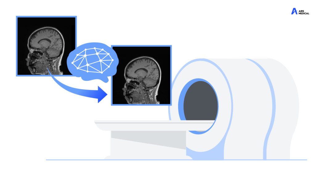 MRI Through the Eyes of Artificial Intelligence: Principles of High ...