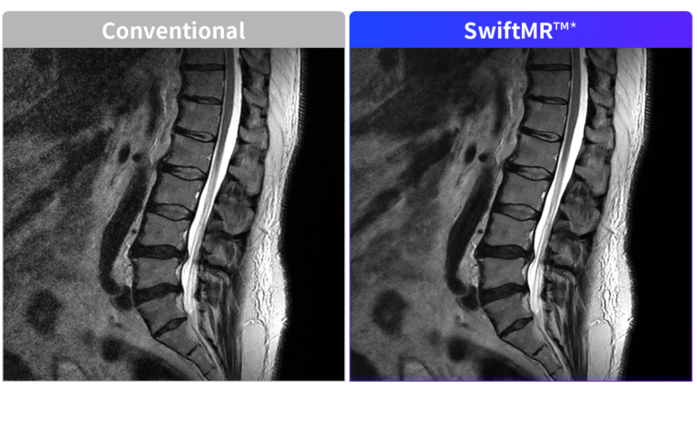 L-Spine T2WI - 0.6T FONAR UPRIGHT Multi-Position MRI