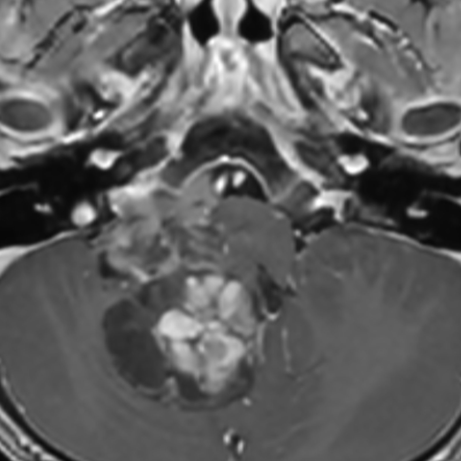 MRI Scan, Pediatric with SwiftMR