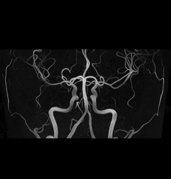 SwiftMR Turbo - Brain - Siemens 3.0T - MRA1-updated