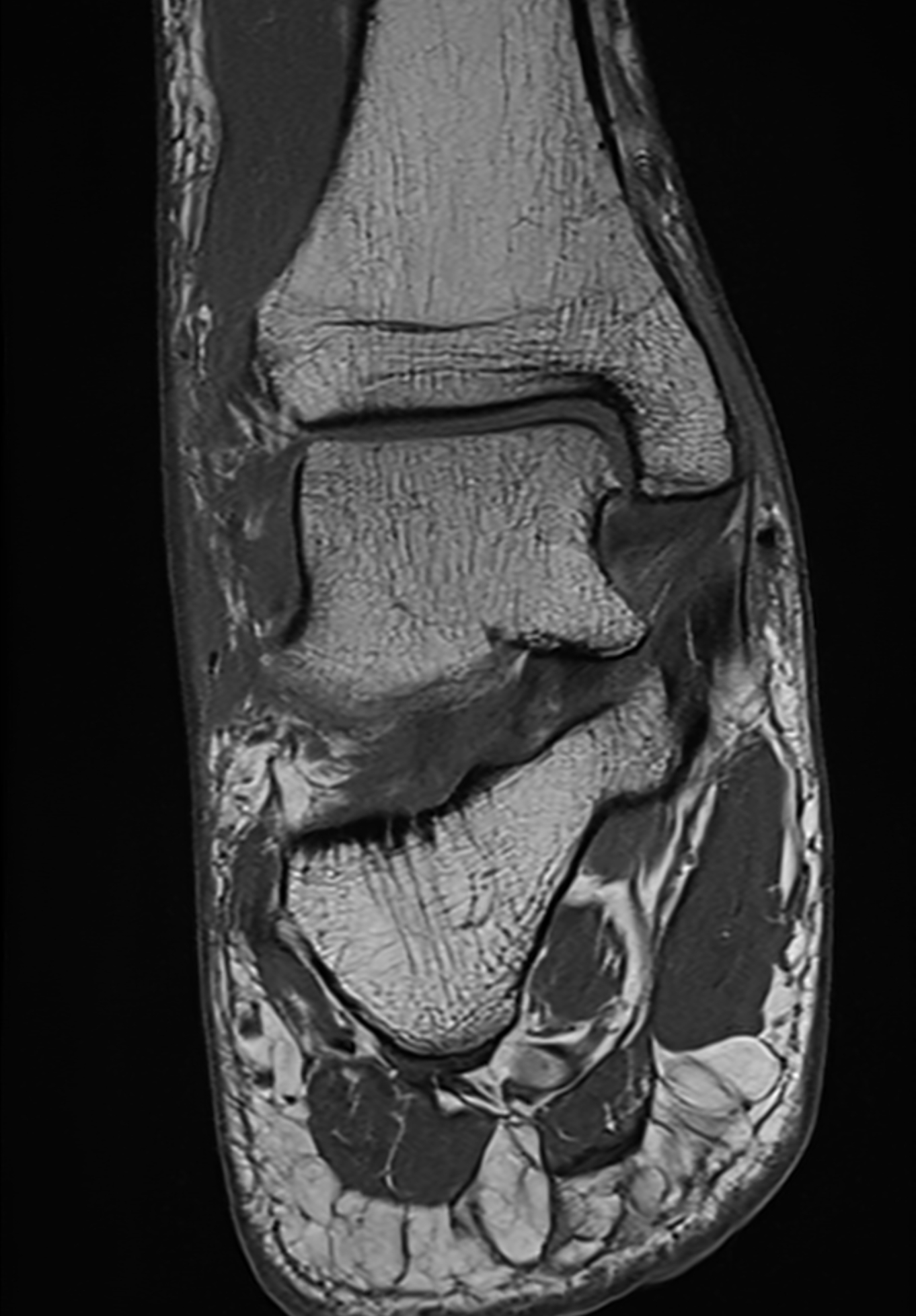 Right Image