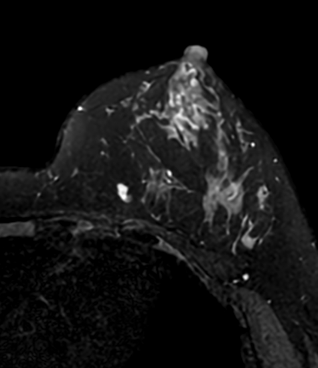 Right Image