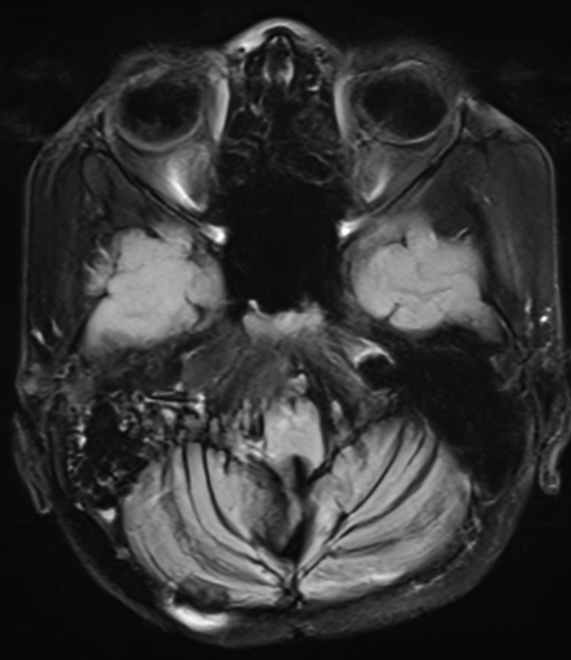 Right Image