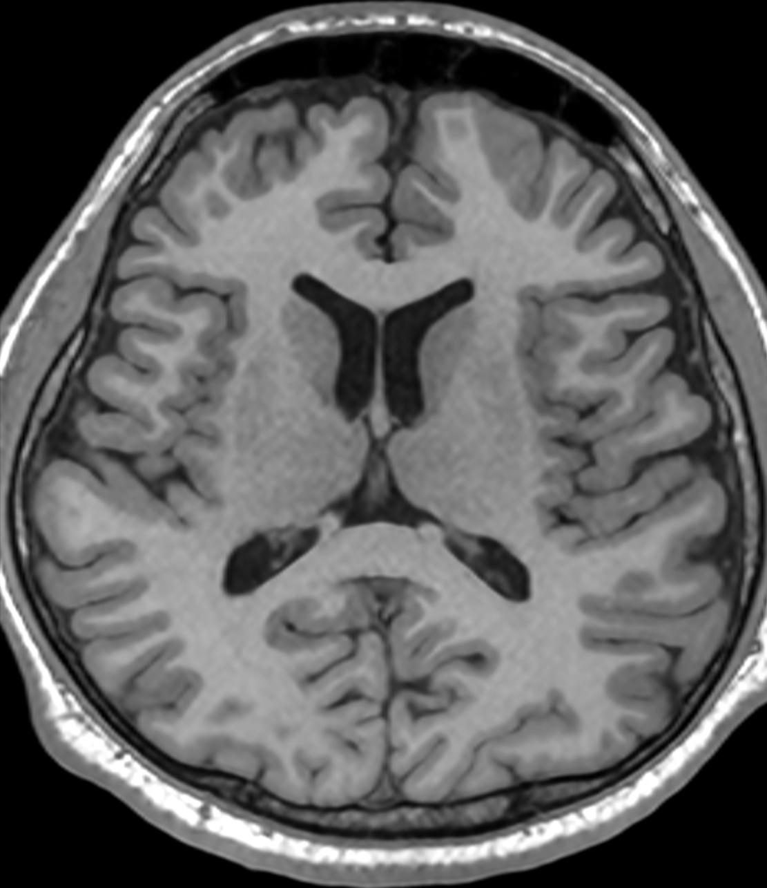 Right Image