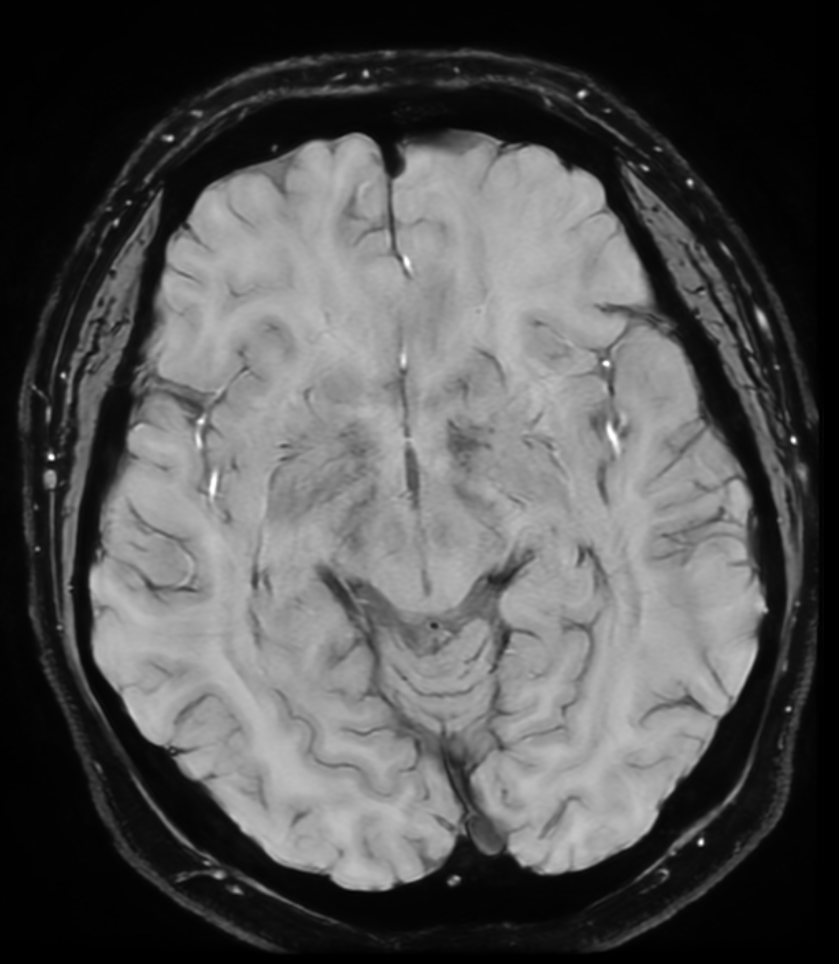 Right Image