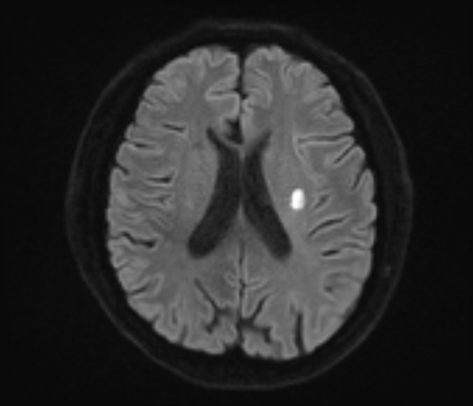 Left Image