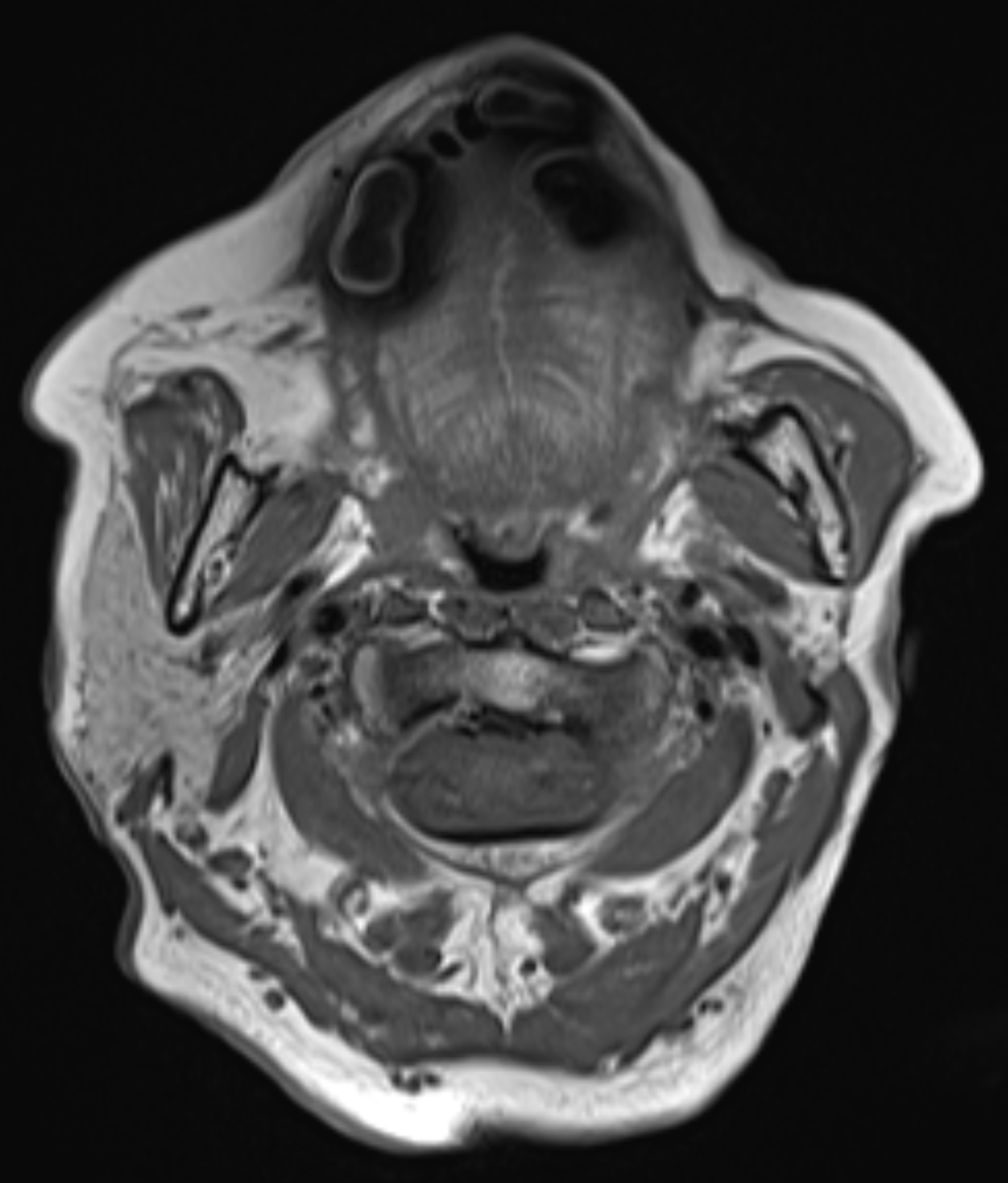 Left Image
