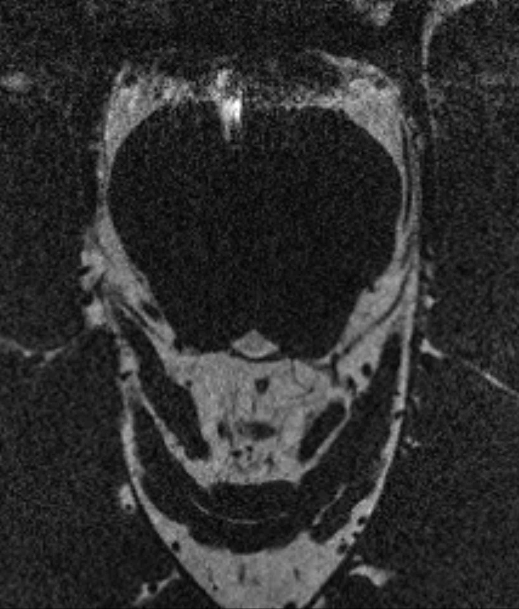 Left Image