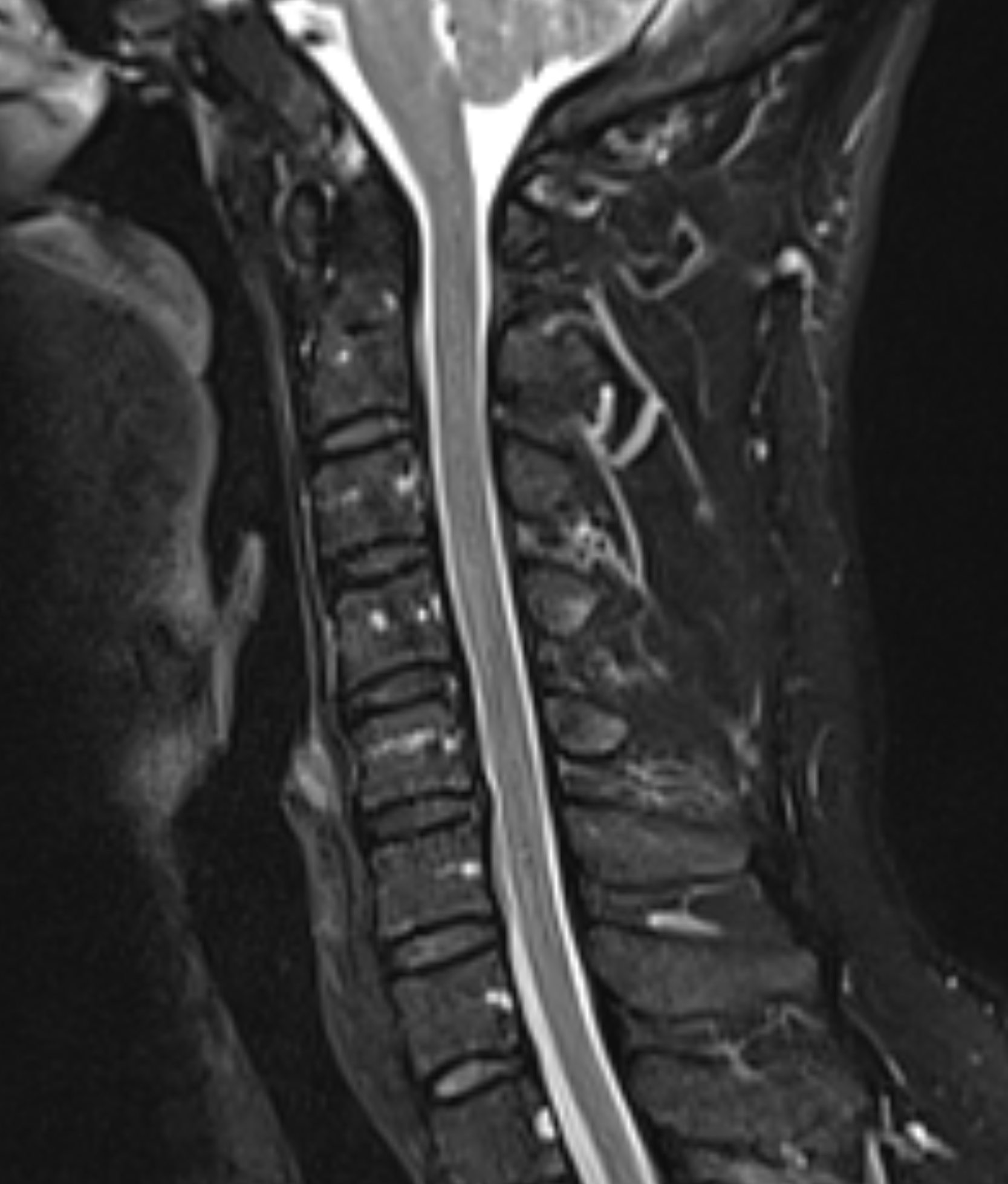 Left Image