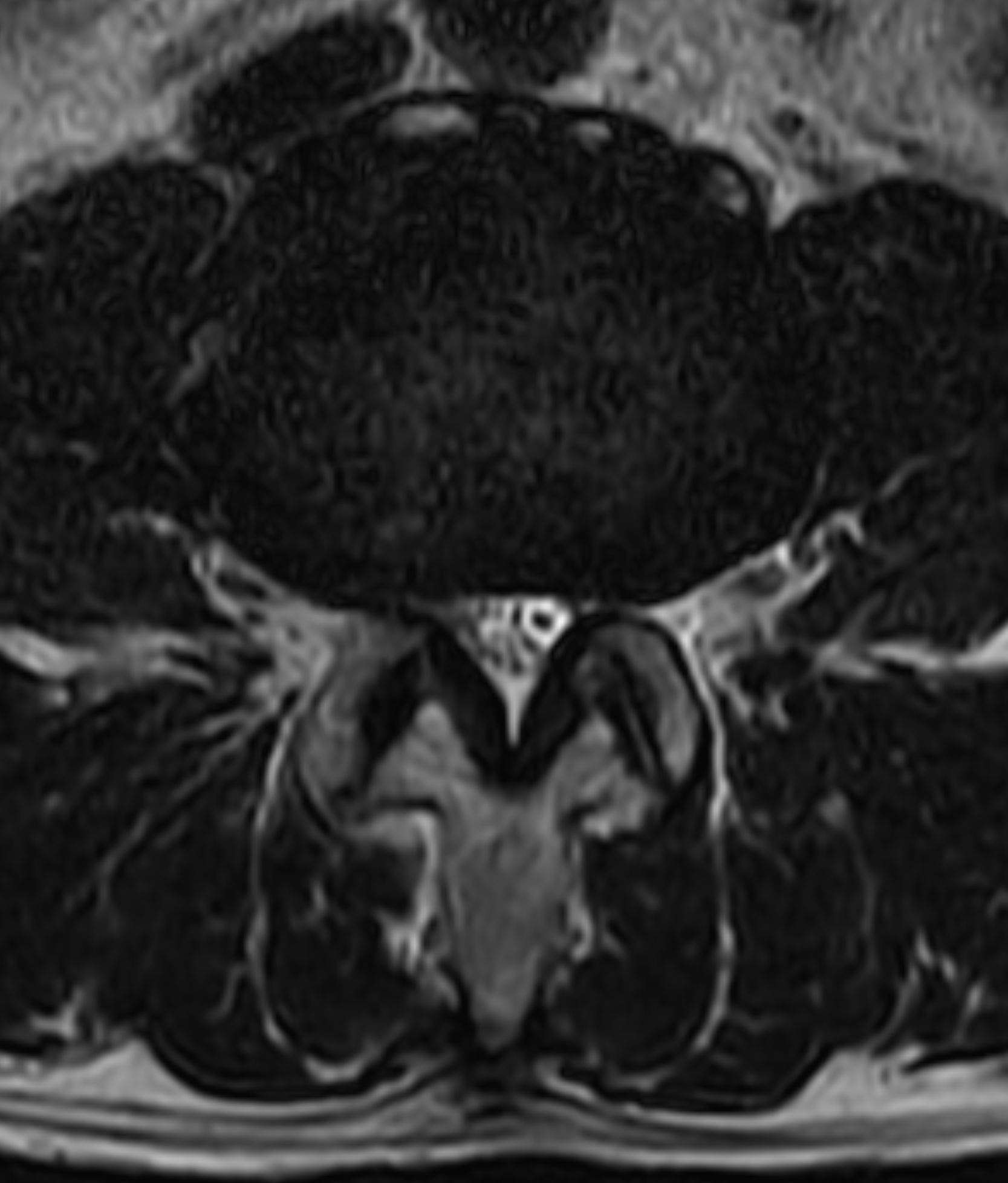 Left Image