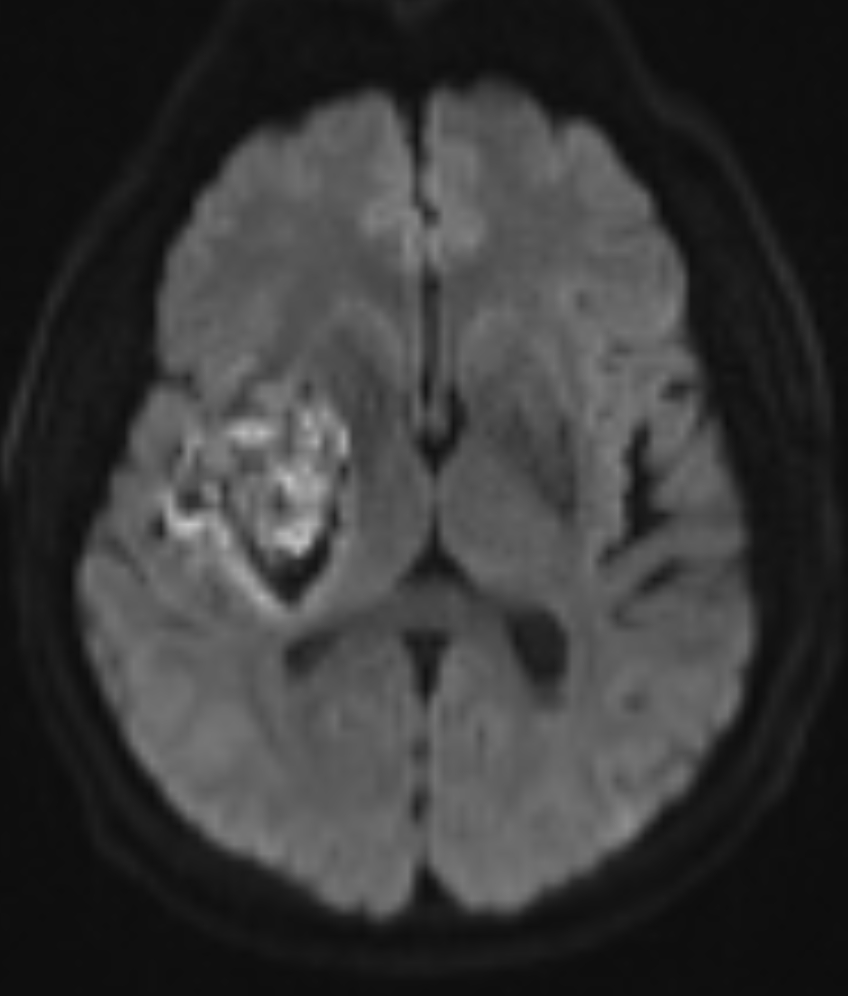 Left Image