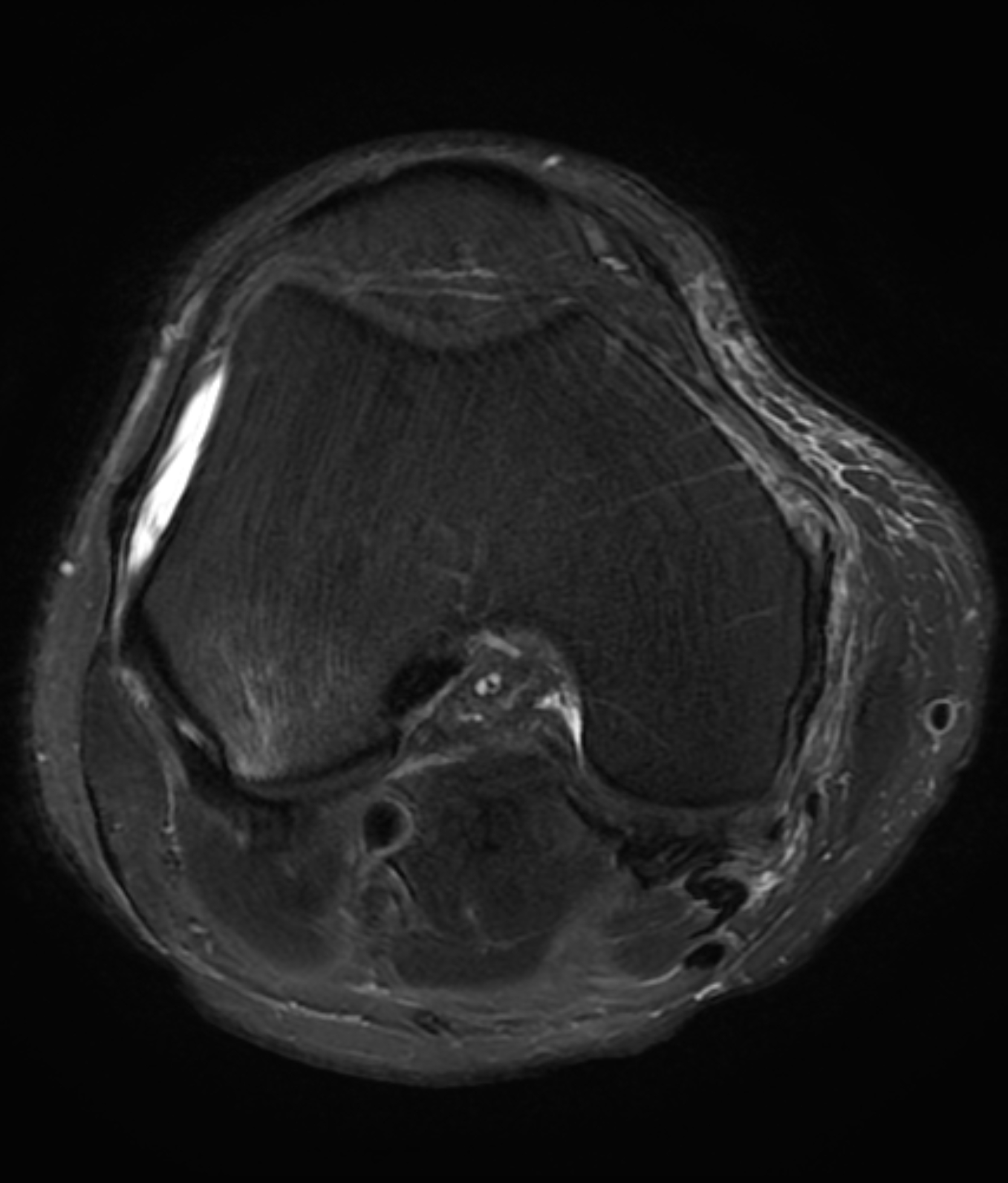 Left Image