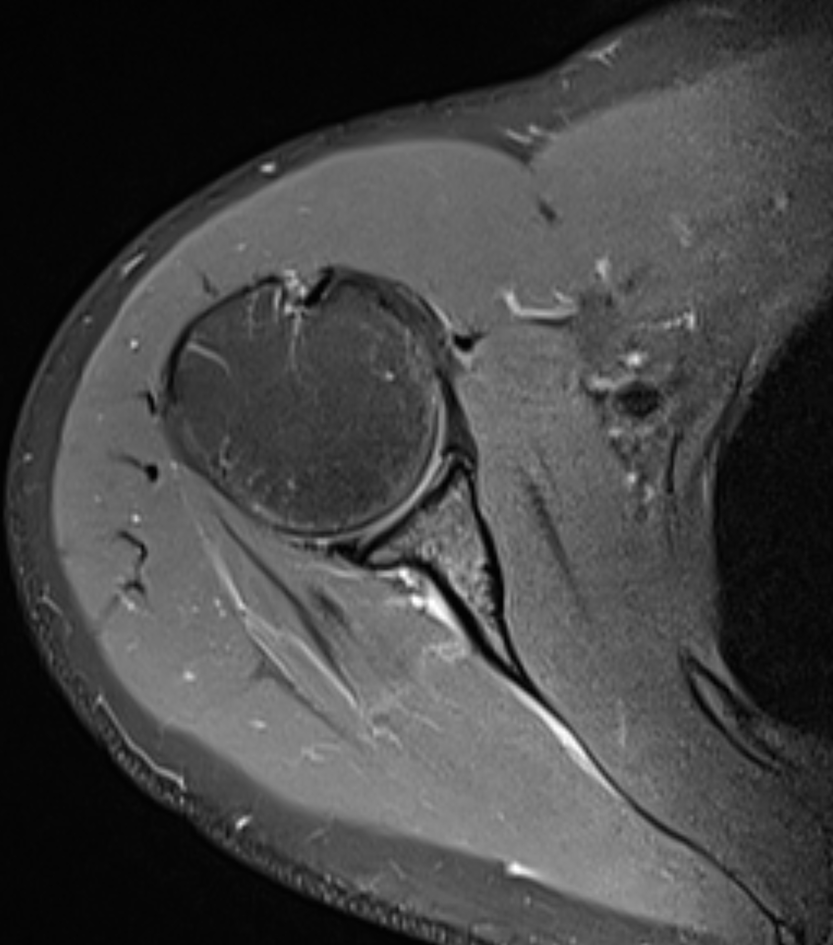 Left Image