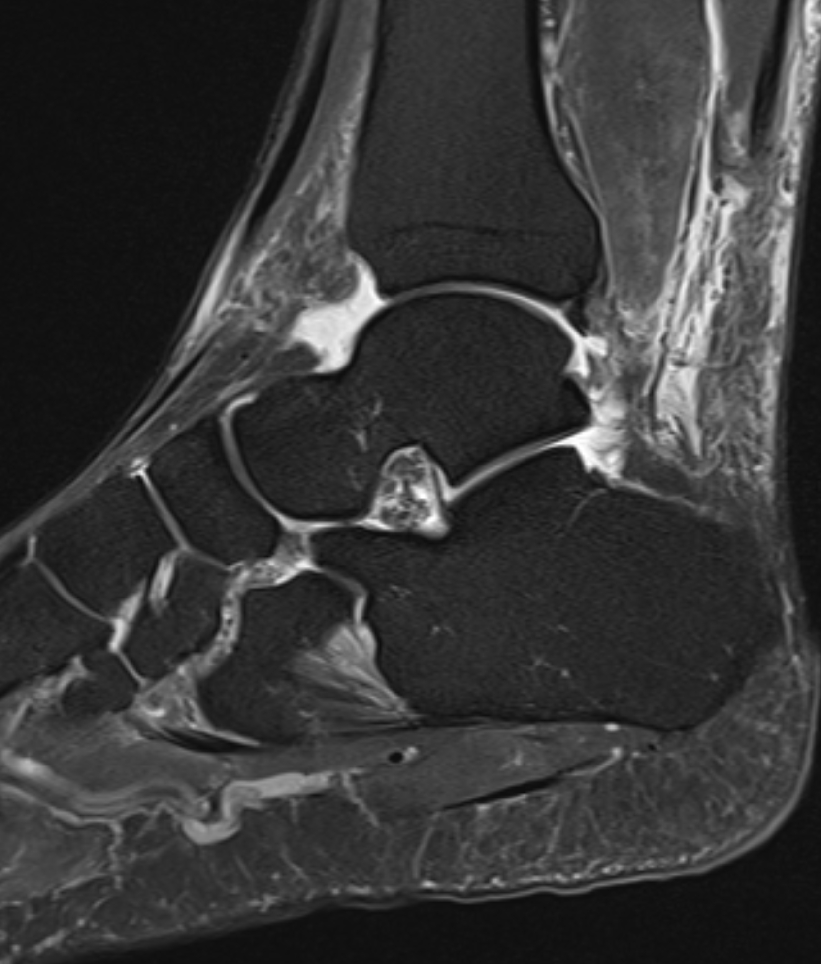 Left Image