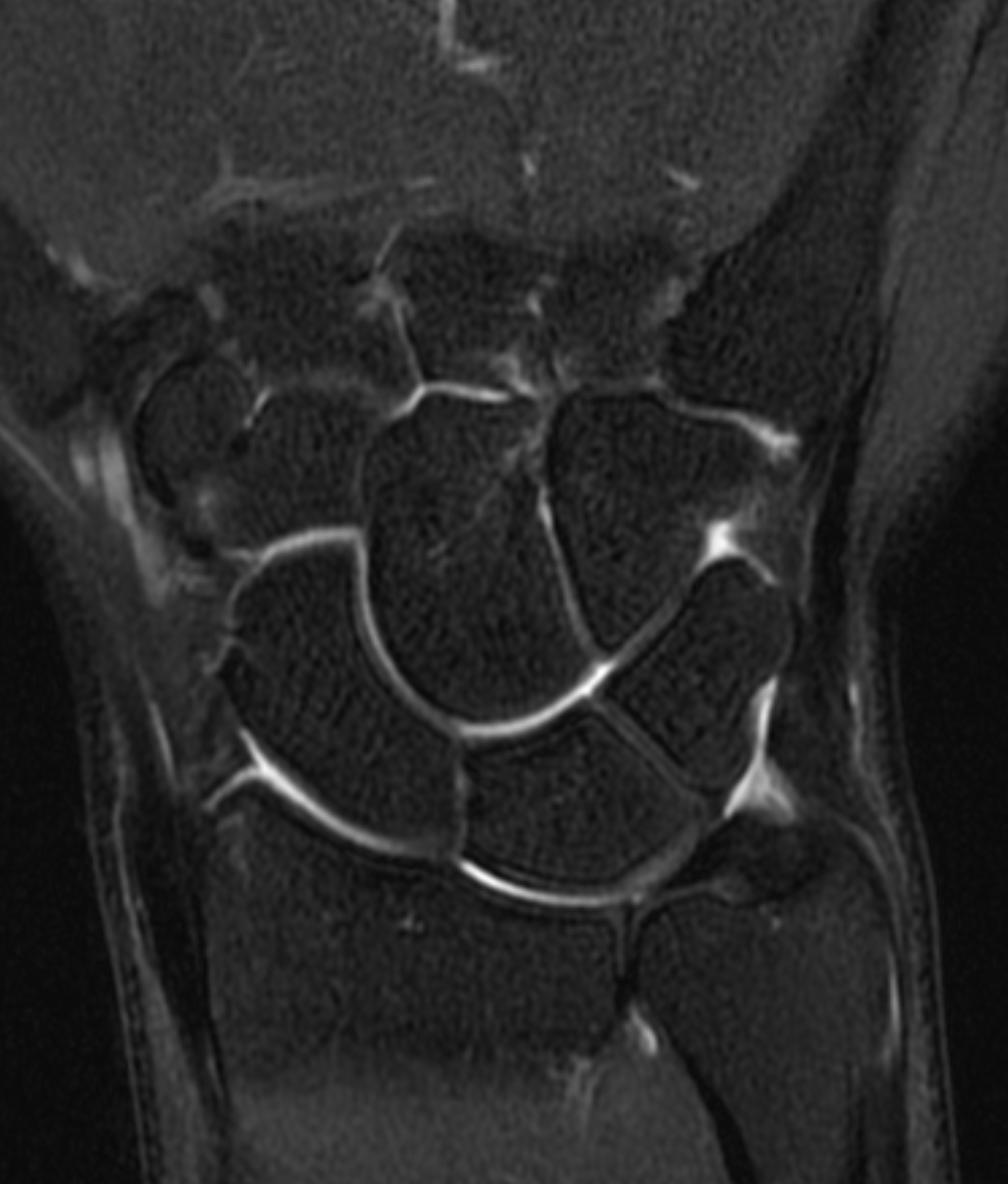 Left Image