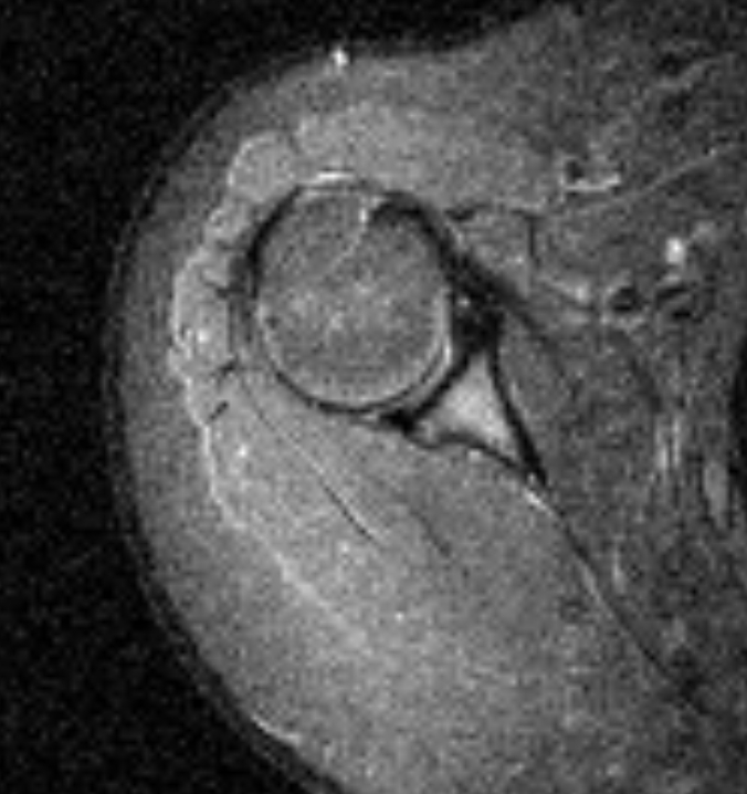 Left Image