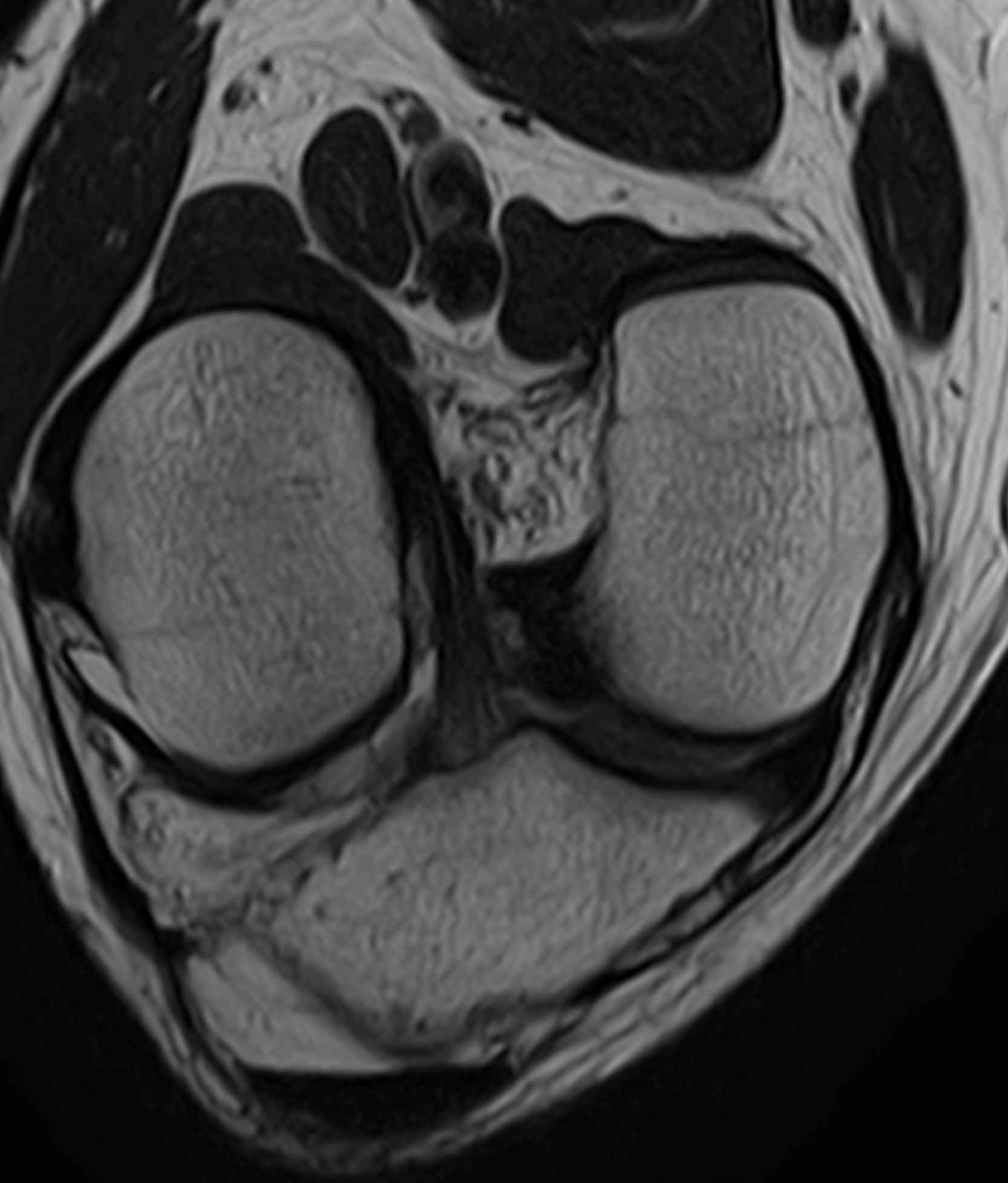 Left Image