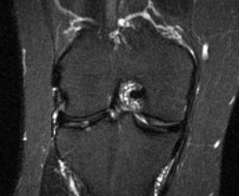 Left Image