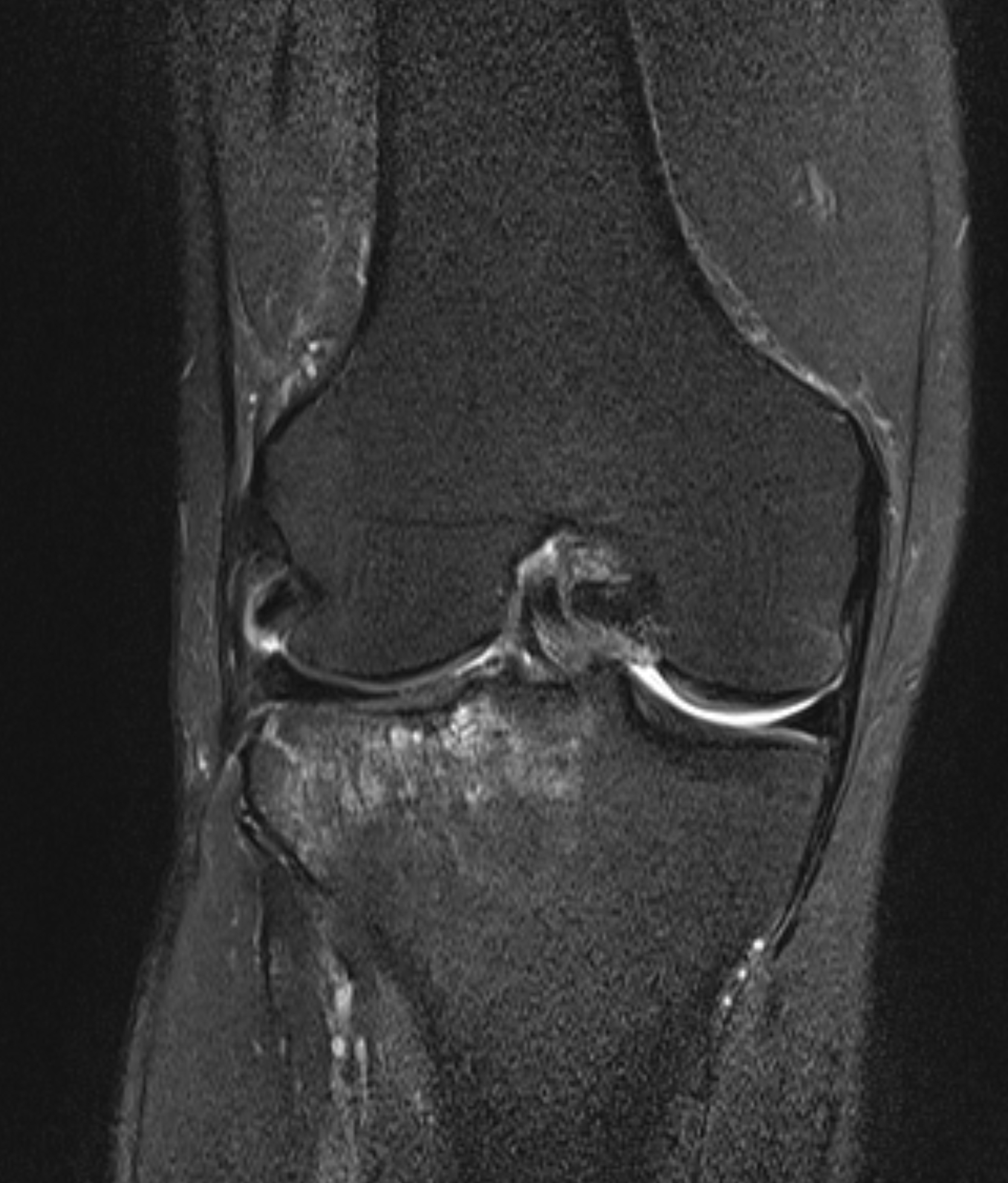 Left Image