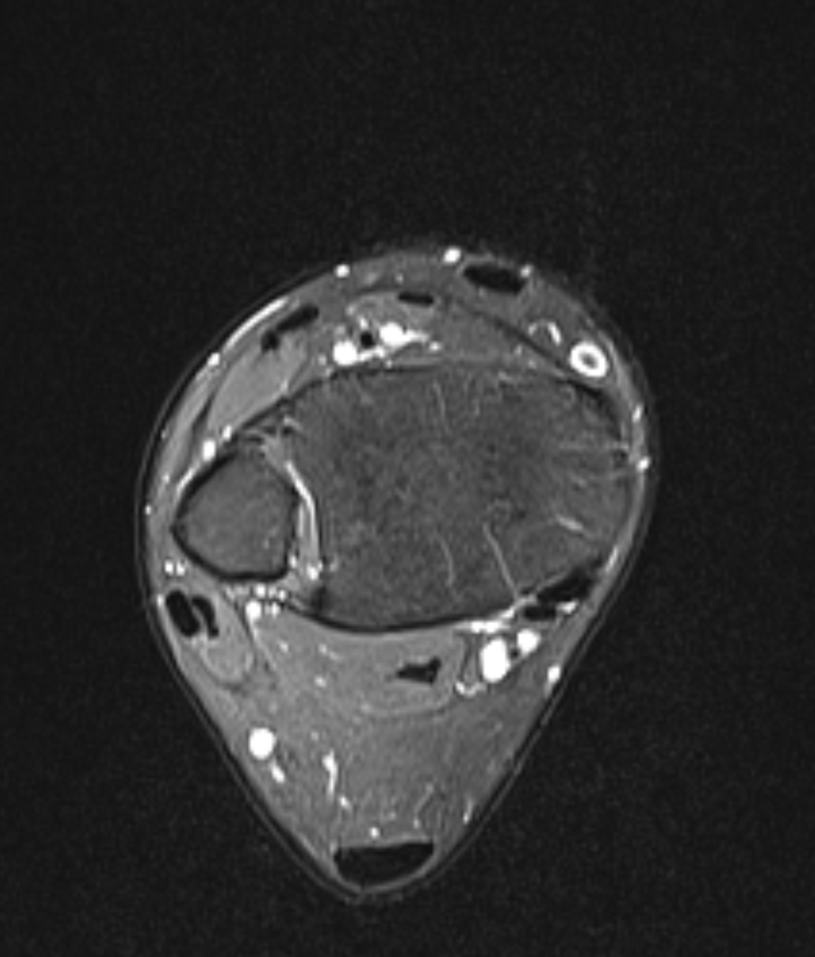 Left Image