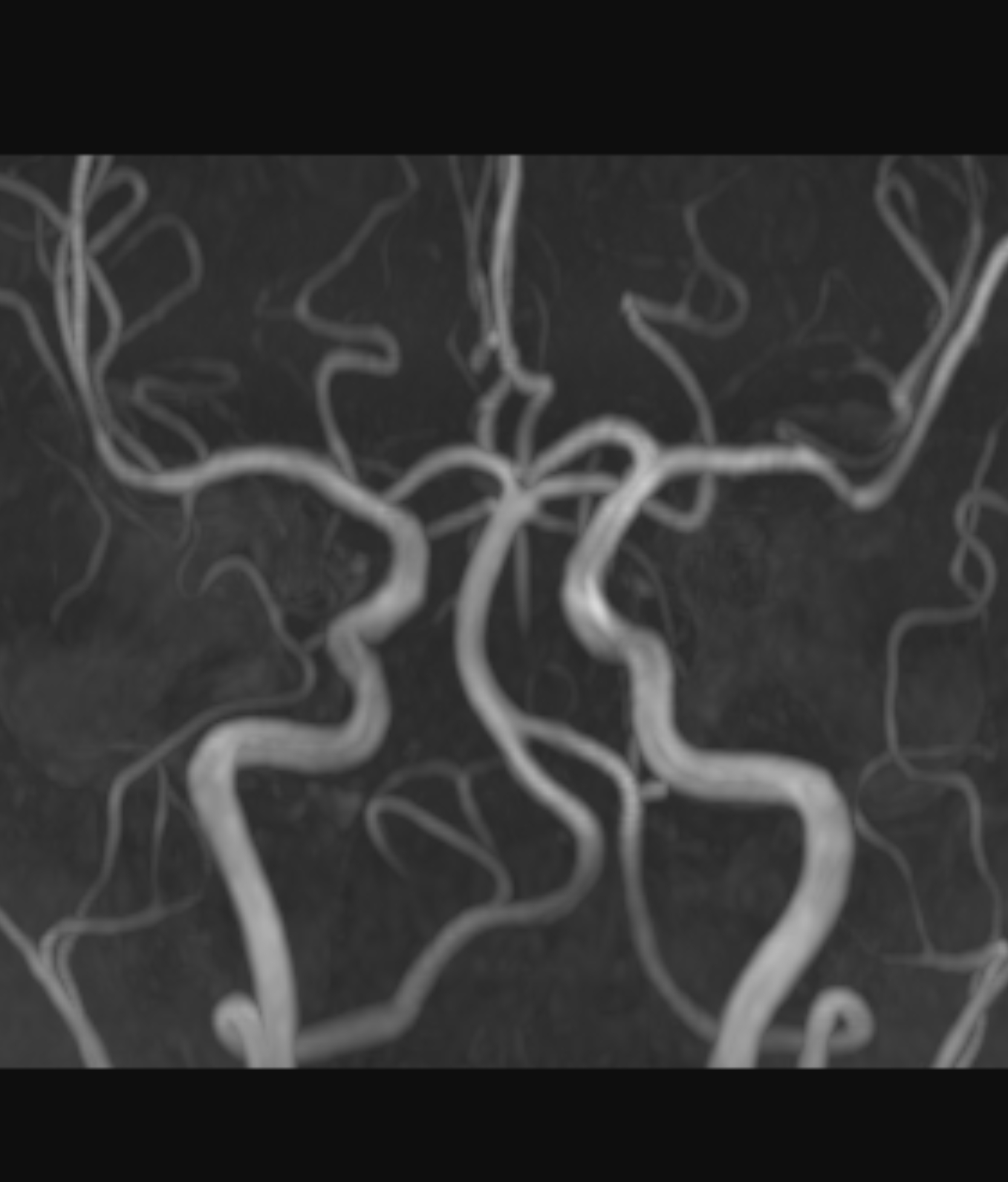 Left Image