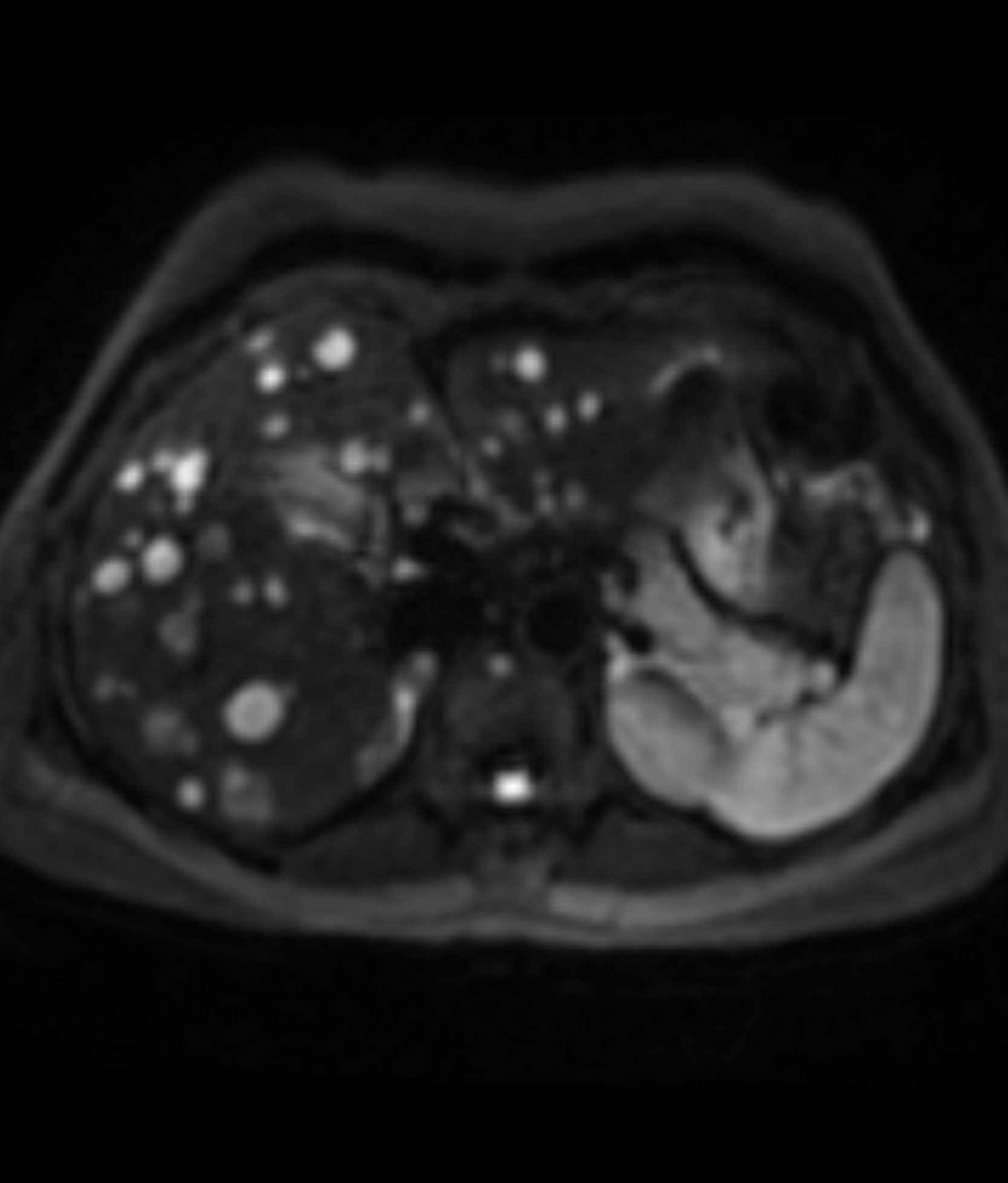 Left Image