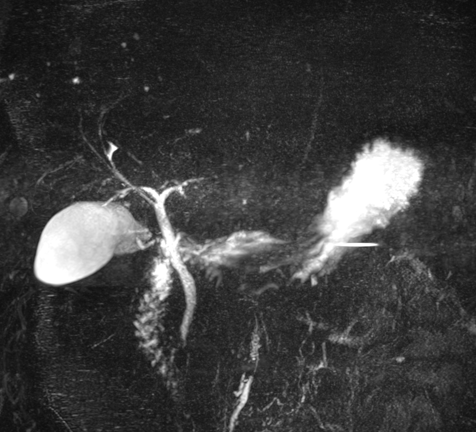 Left Image