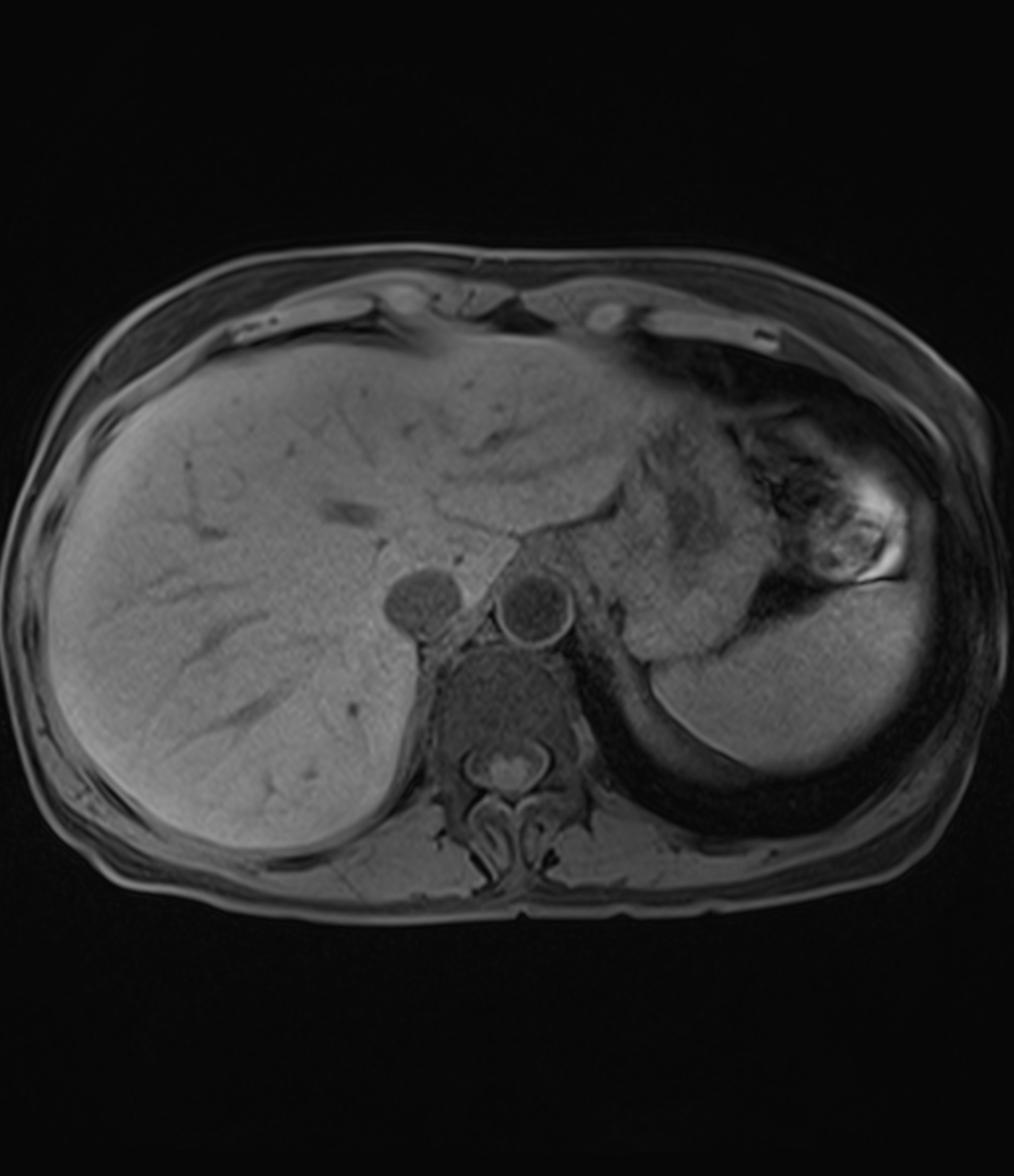 Left Image