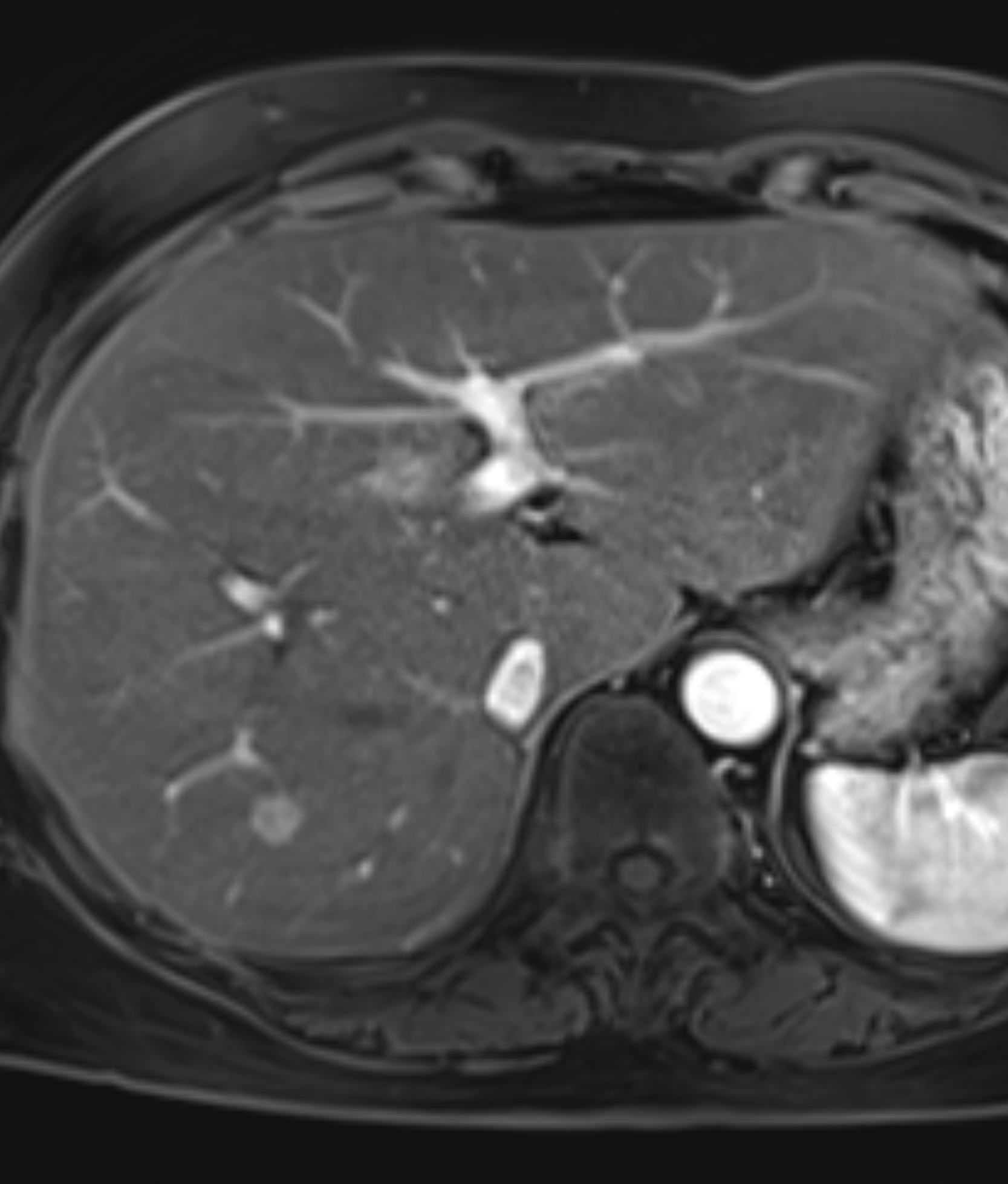 Left Image