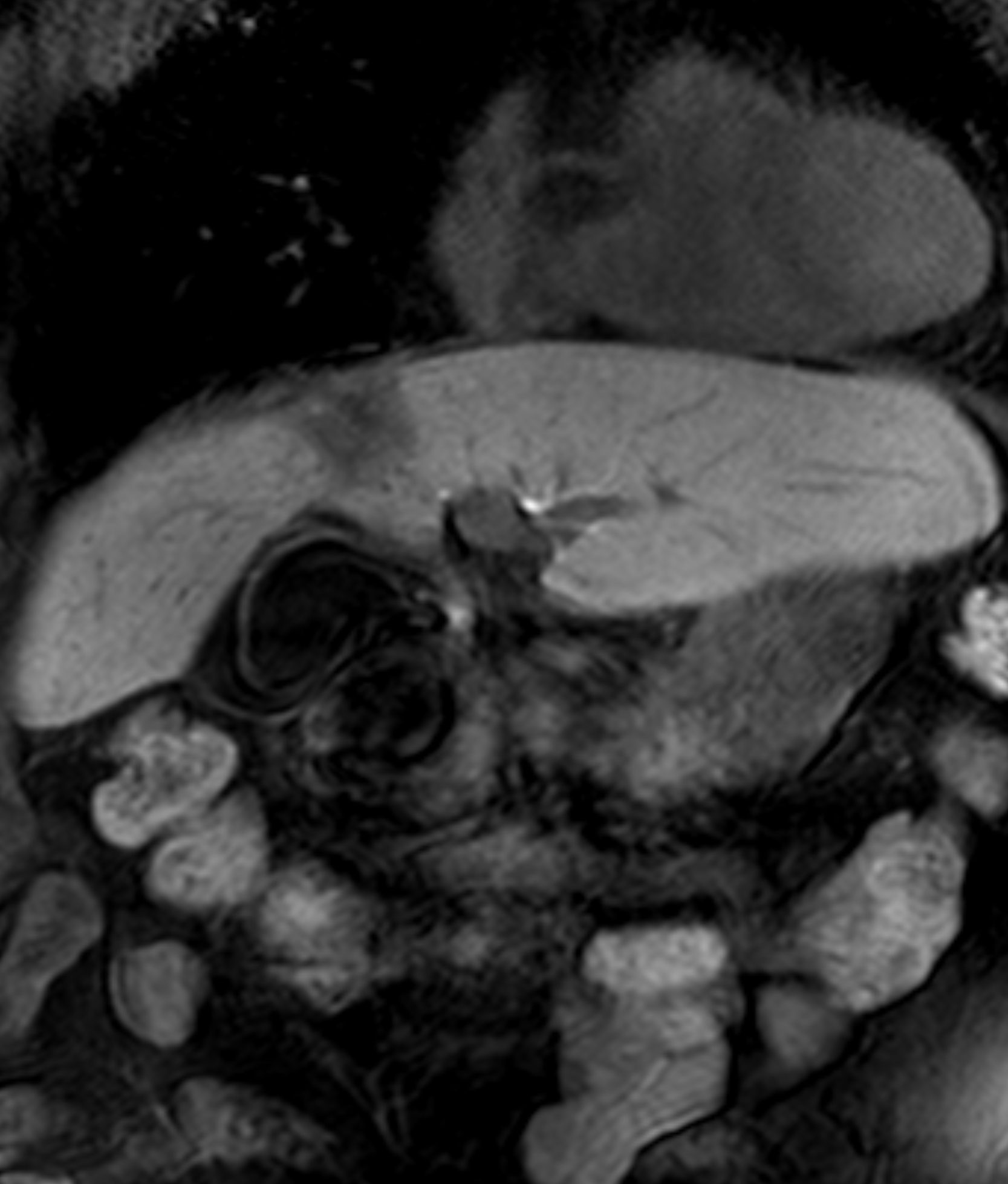 Left Image