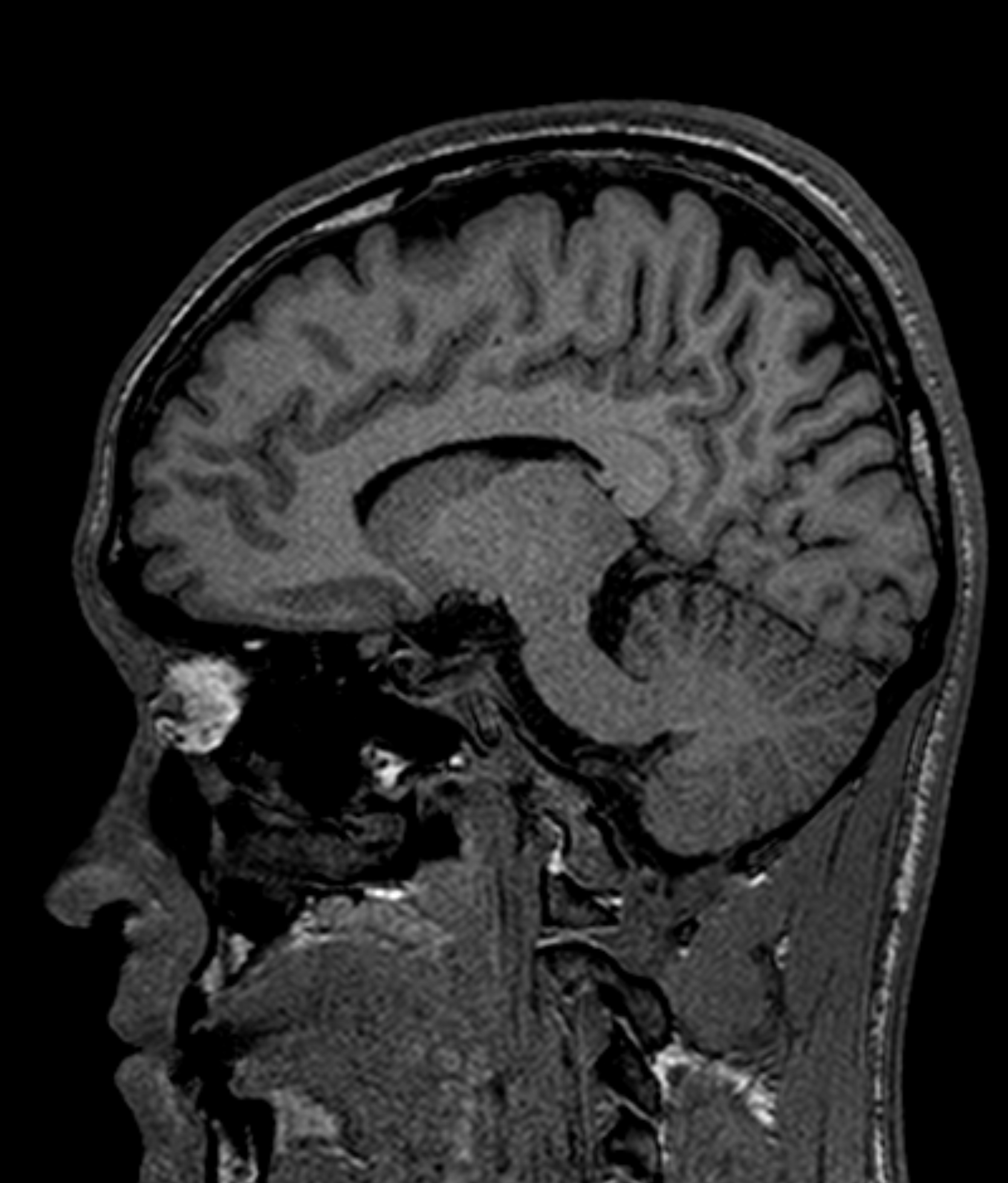 Left Image