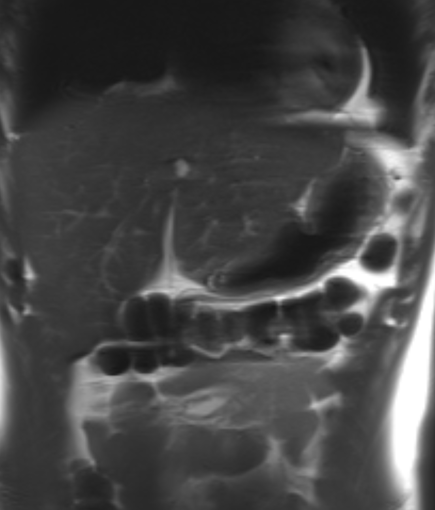 Left Image