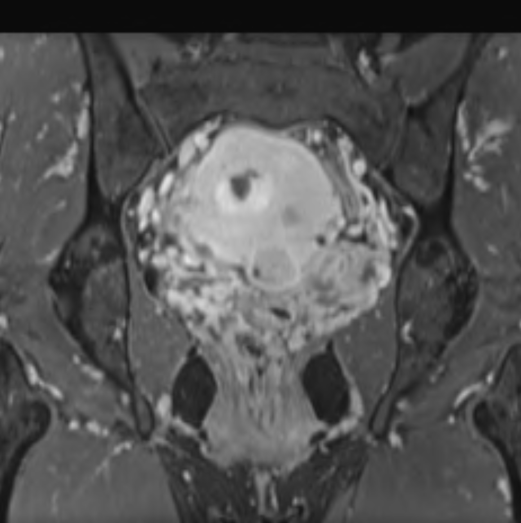 Left Image