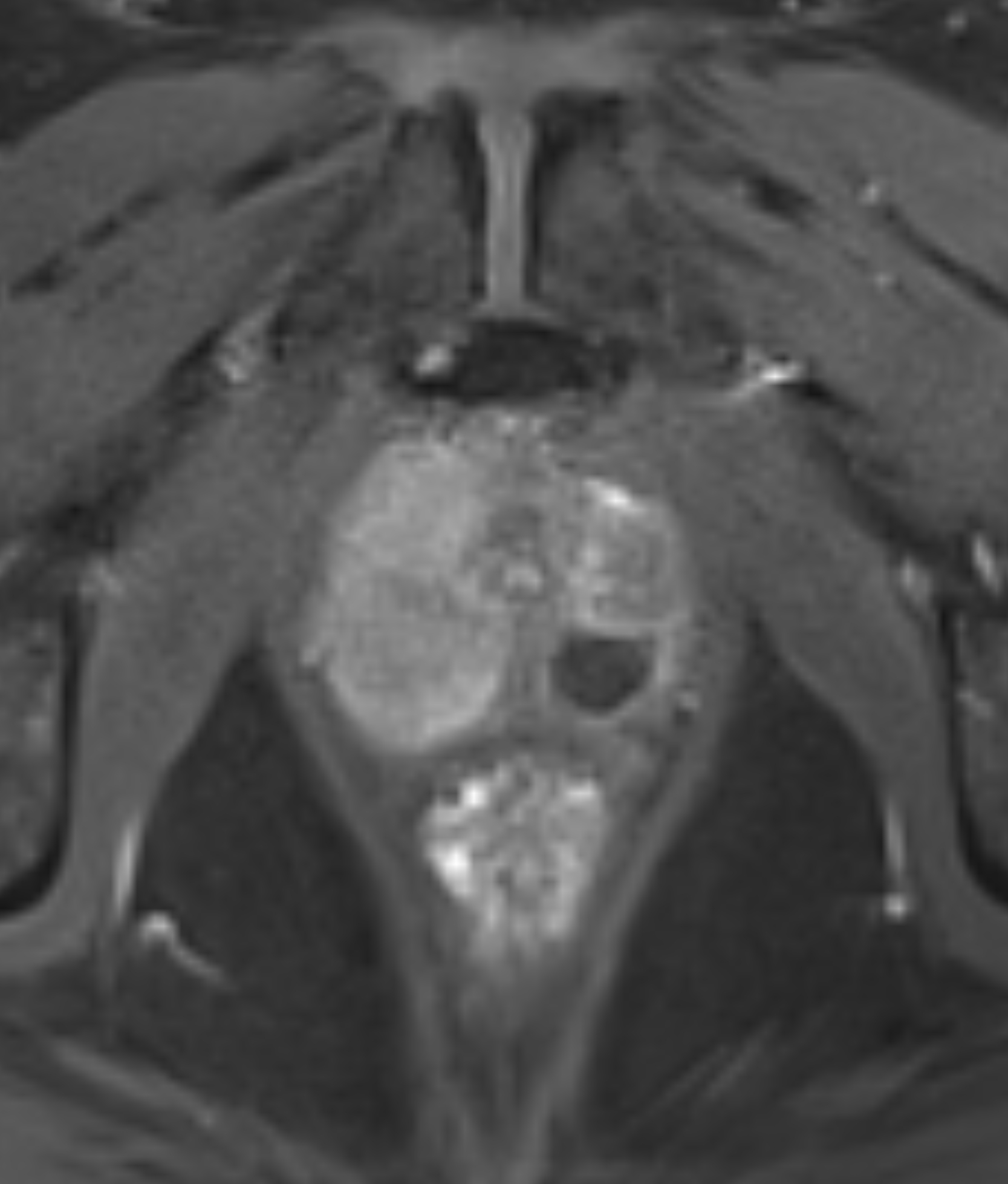 Left Image