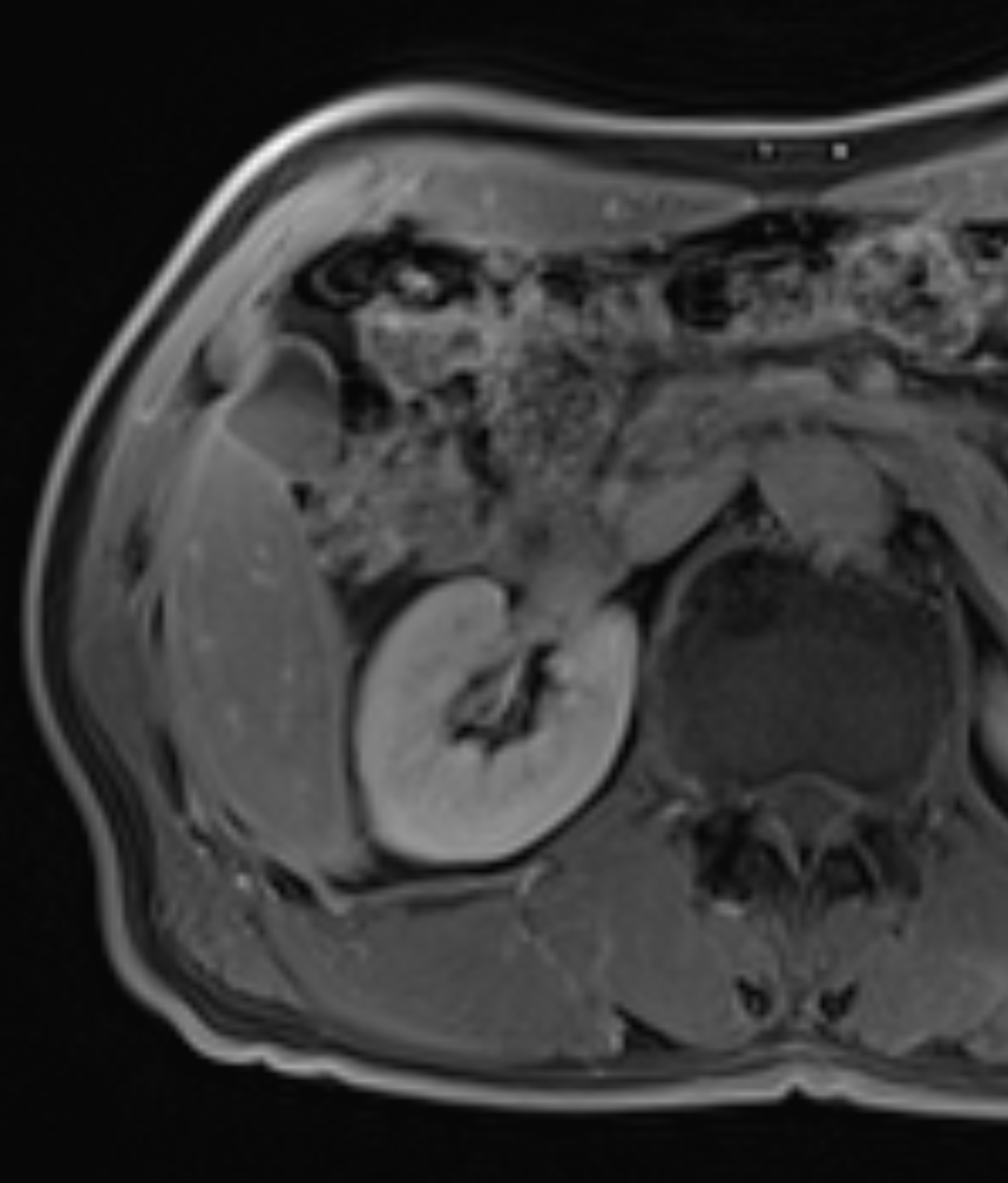 Left Image