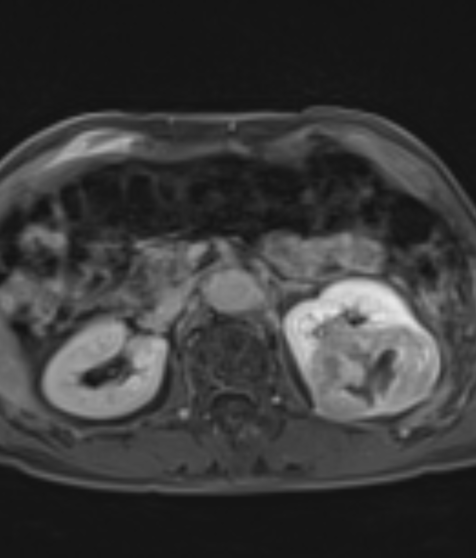 Left Image