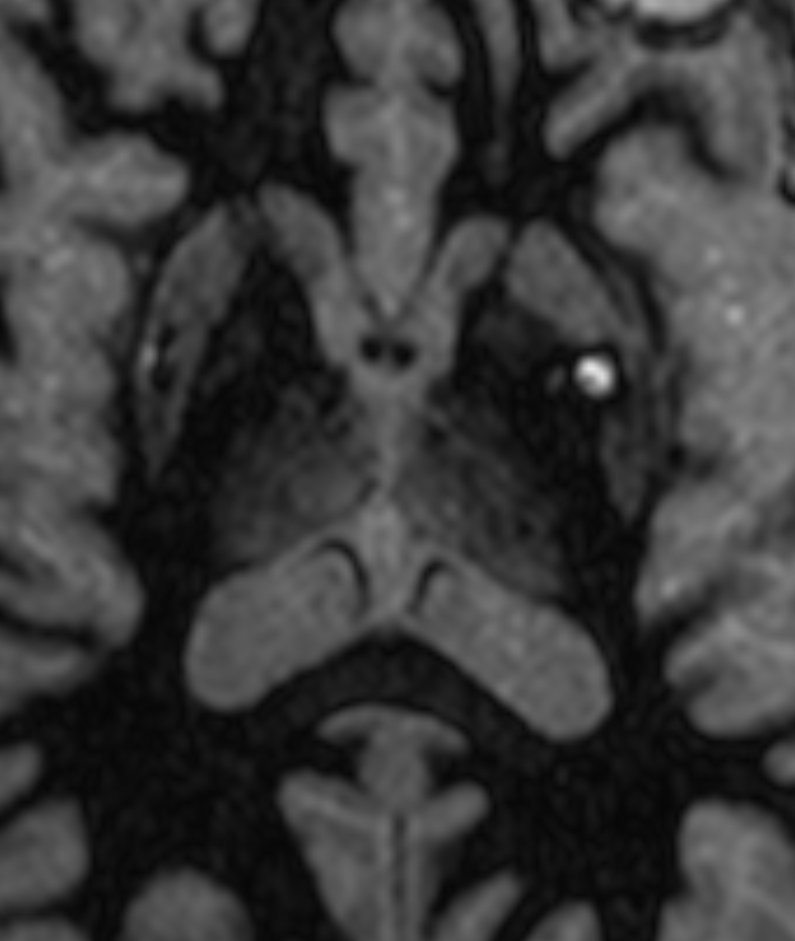 Left Image