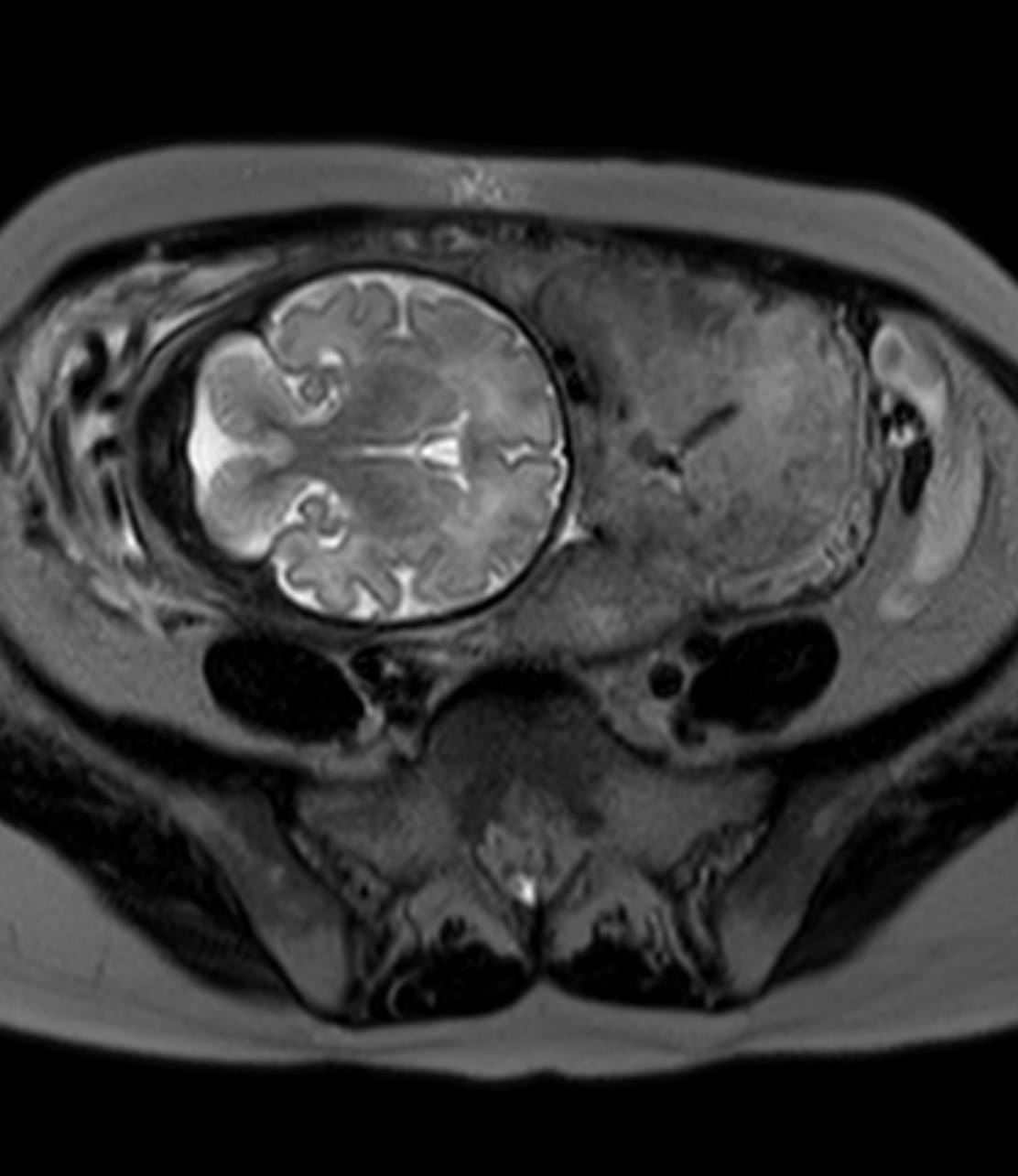 Left Image