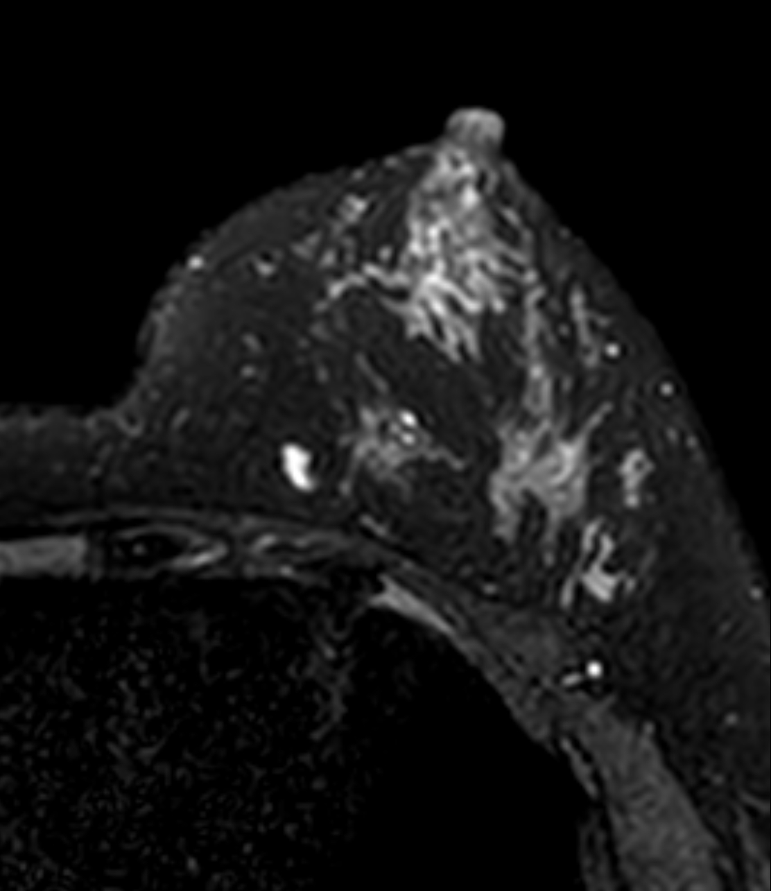 Left Image