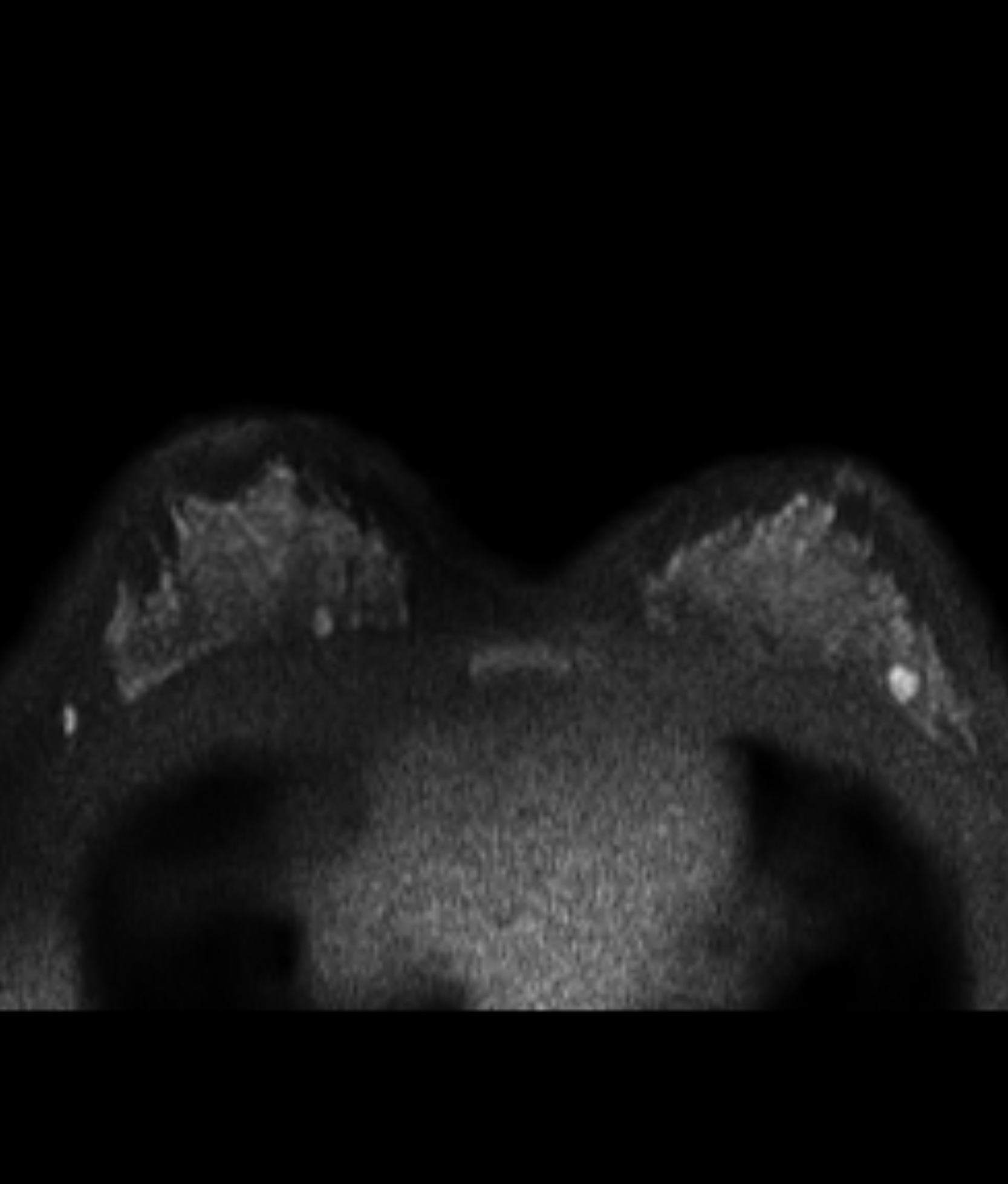 Left Image