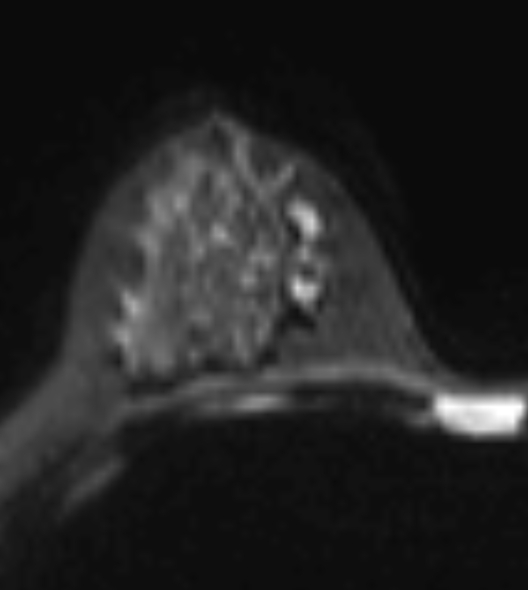 Left Image