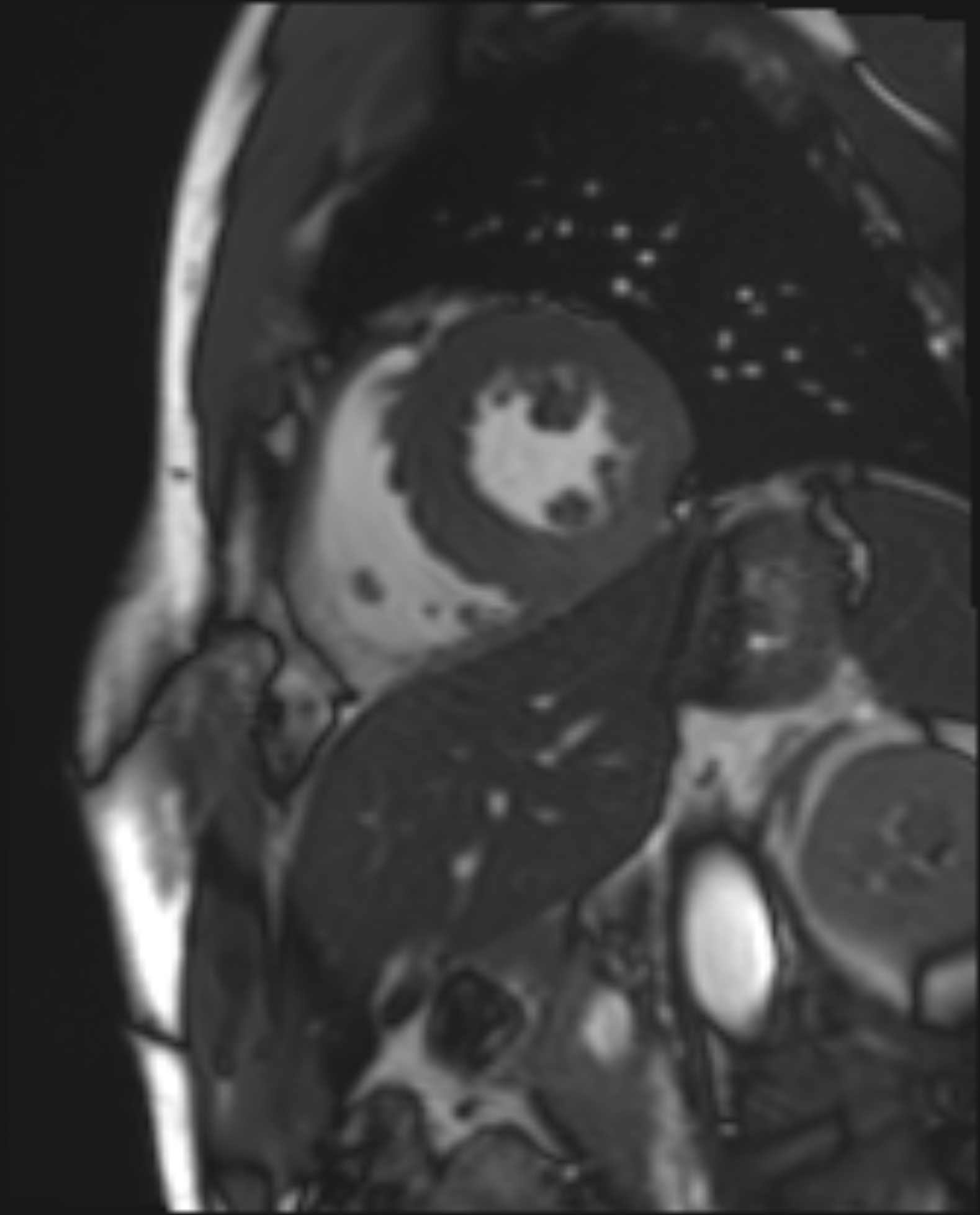 Left Image
