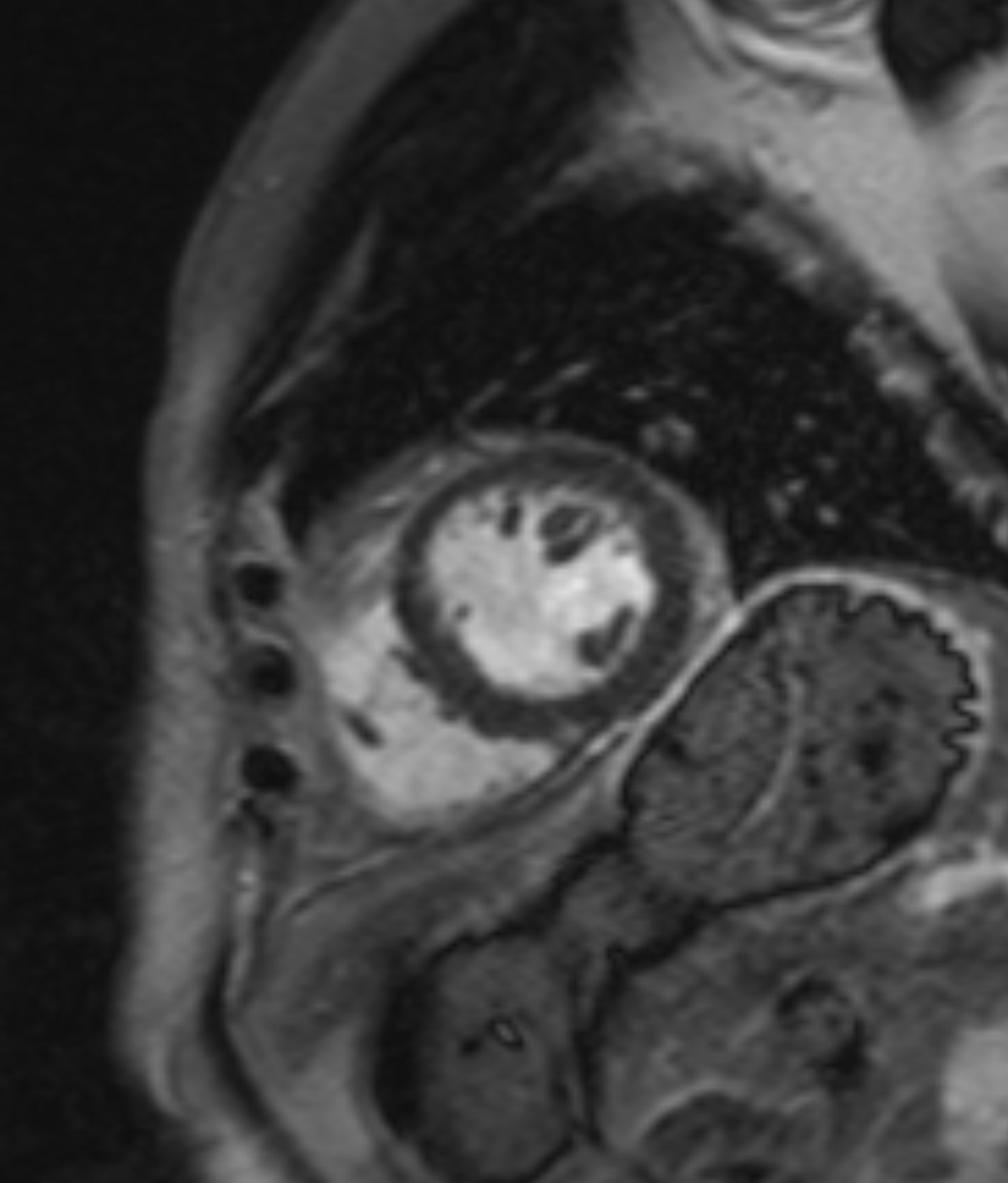 Left Image