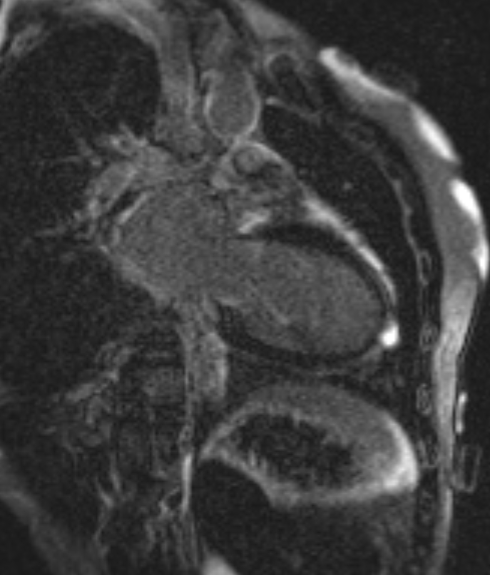 Left Image