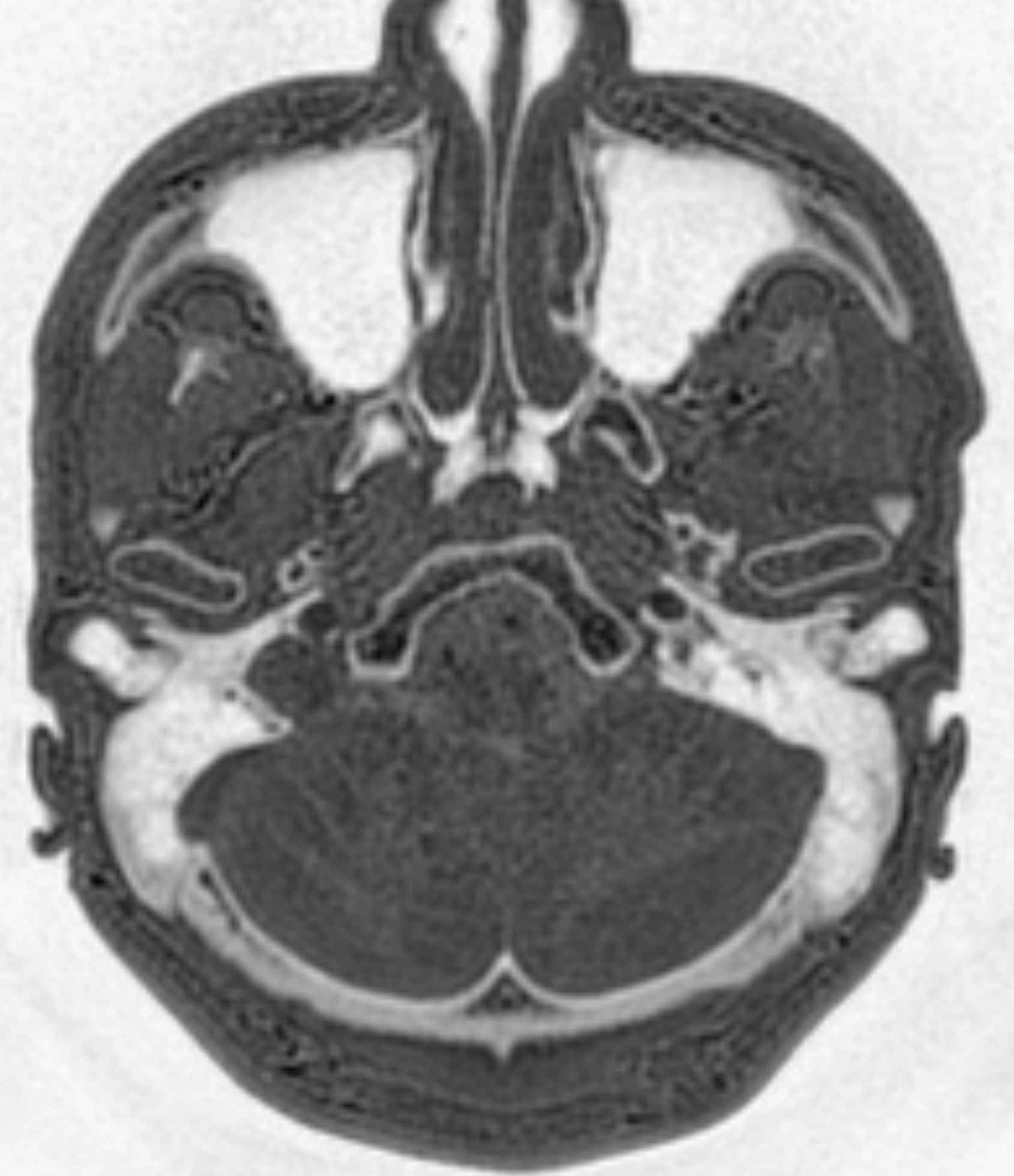 Left Image