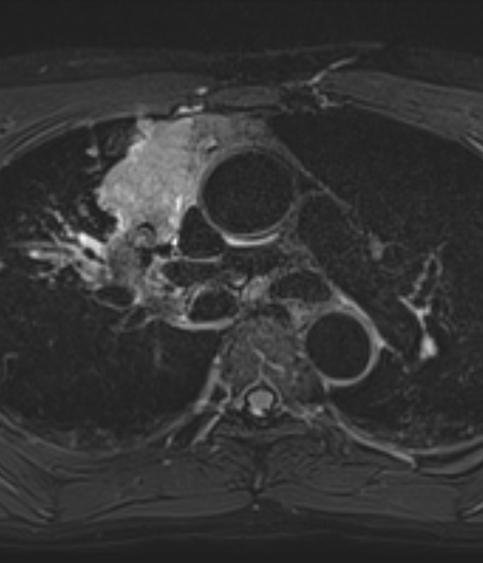 Left Image