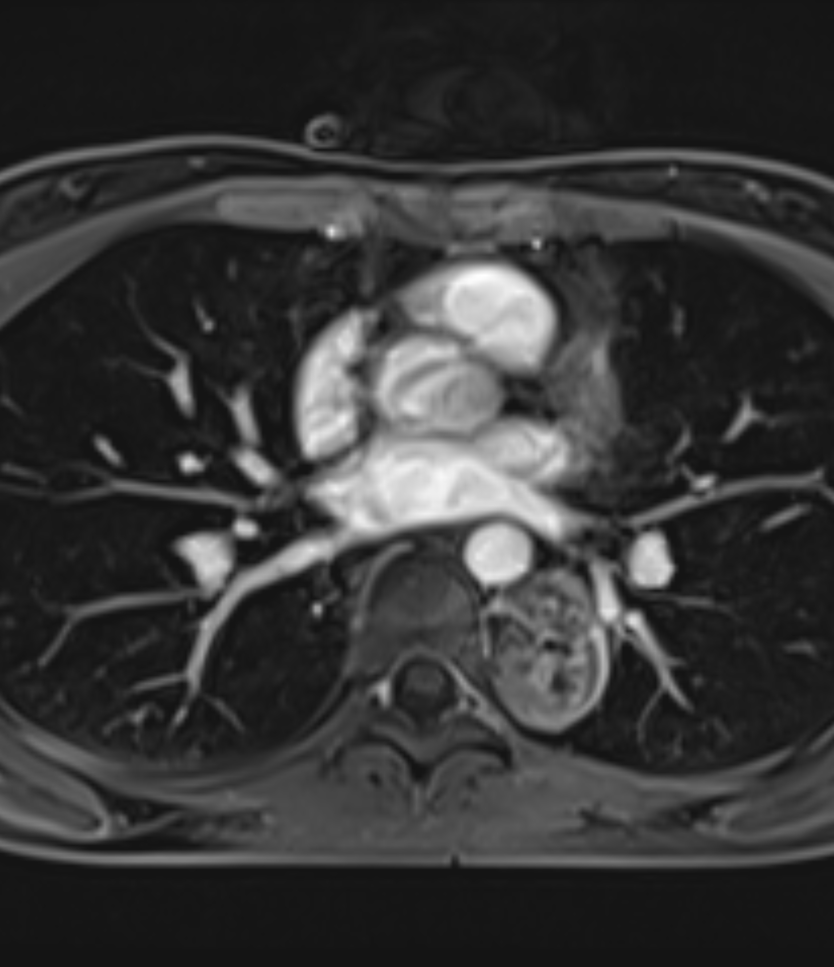 Left Image