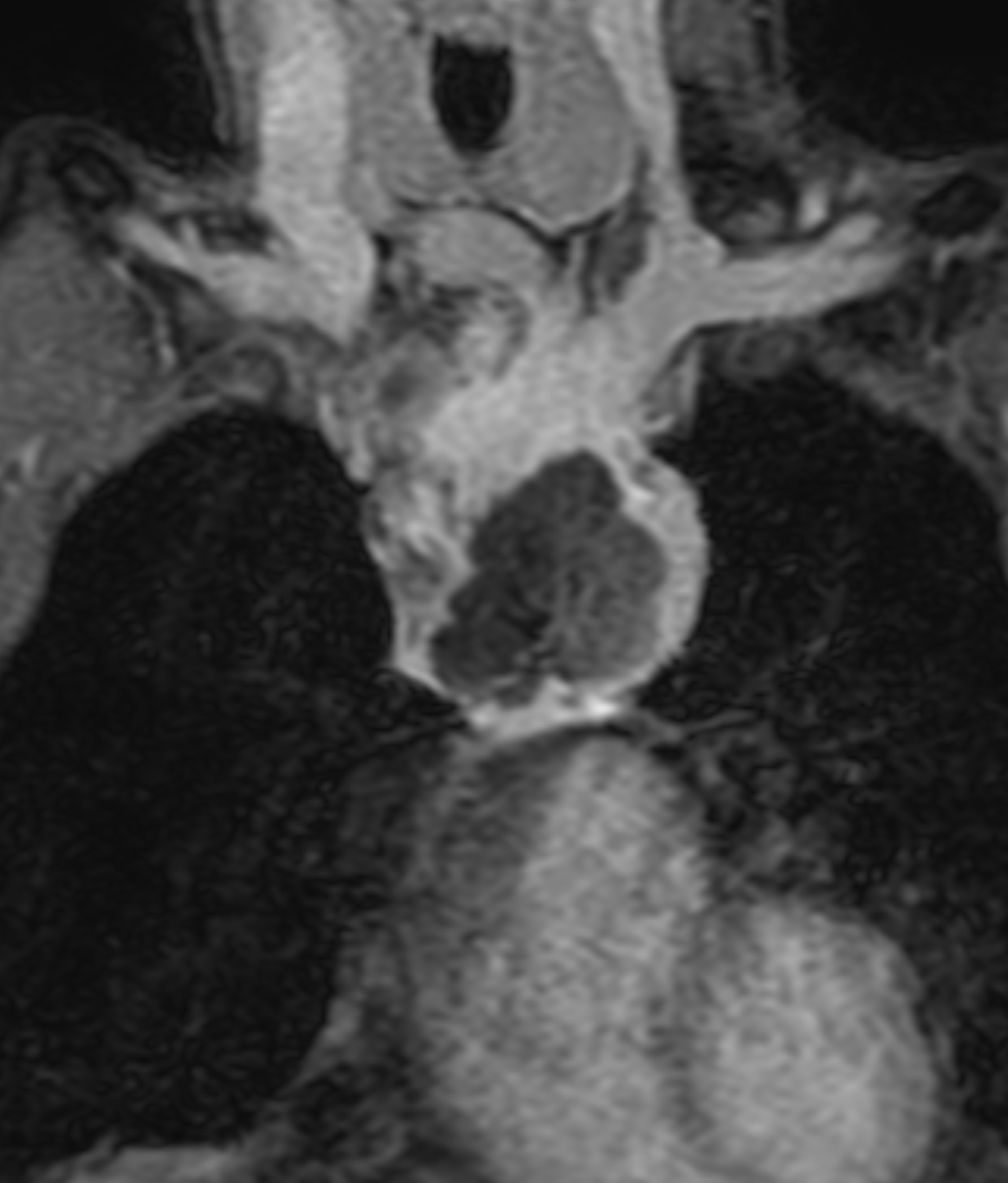 Left Image