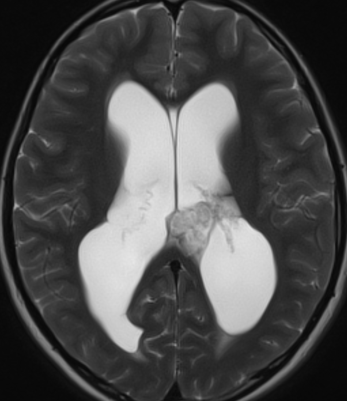 Left Image